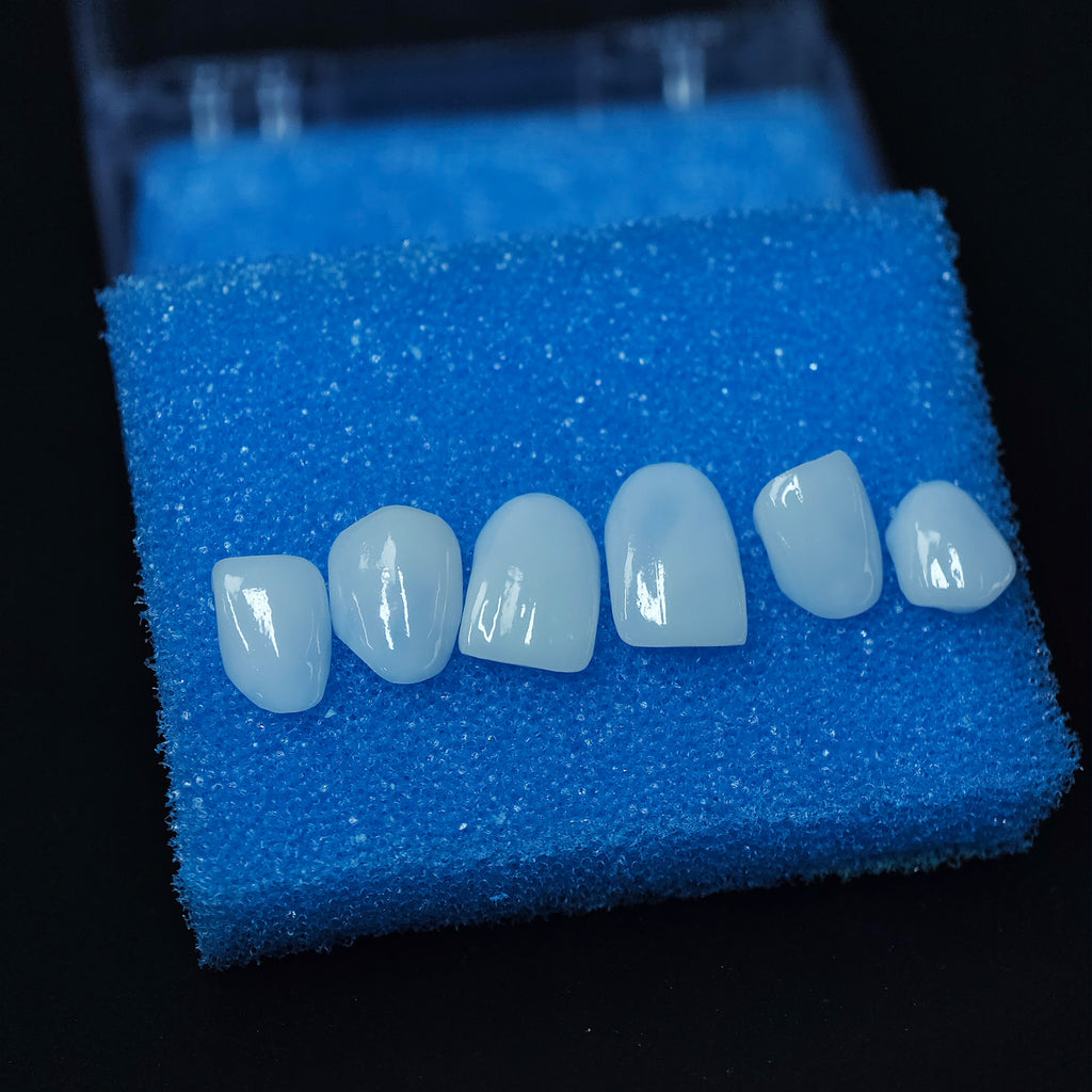 Ultra-Thin Emax Veneer. High Transparency/Translucent, Natural Shade