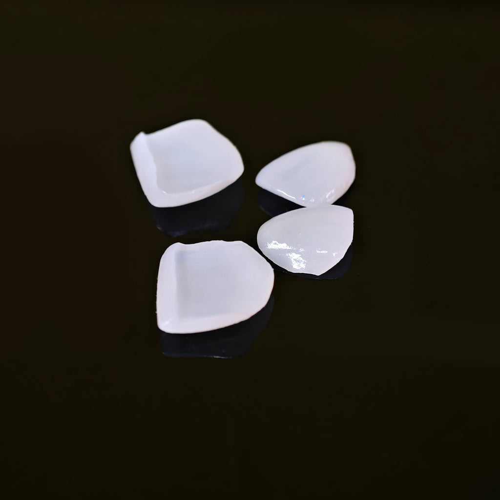Ultra-Thin Emax Veneer. High Transparency/Translucent, Natural Shade
