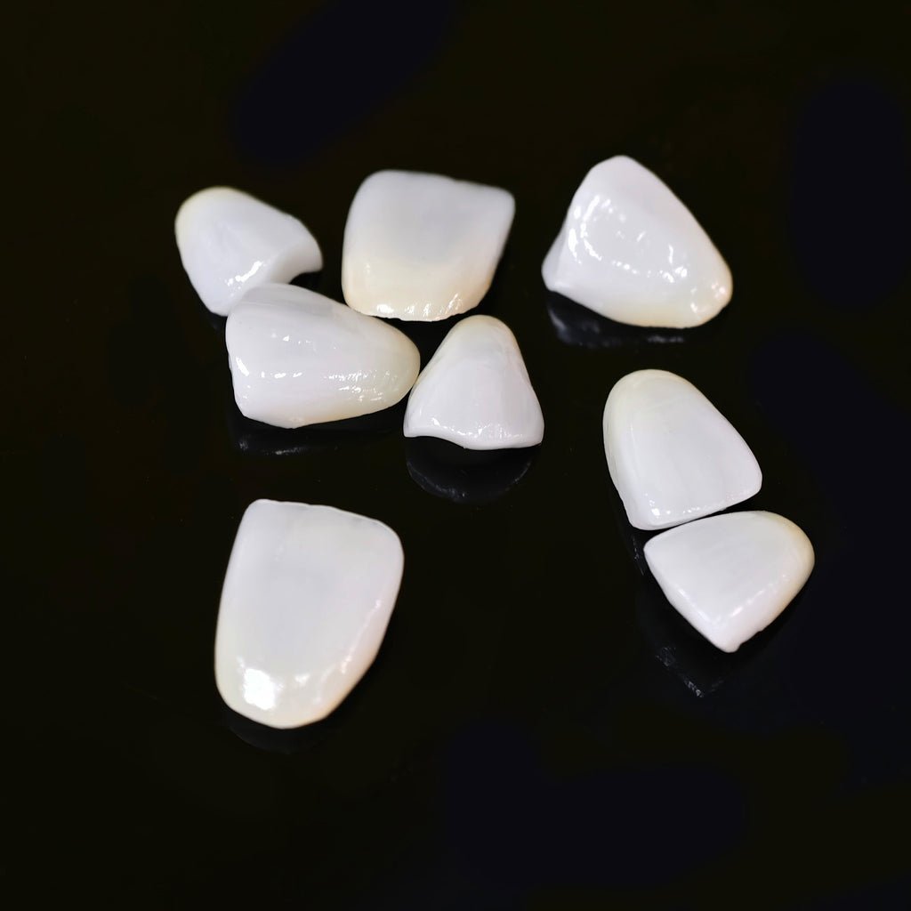 Ultra-Thin Emax Veneer. High Transparency/Translucent, Natural Shade