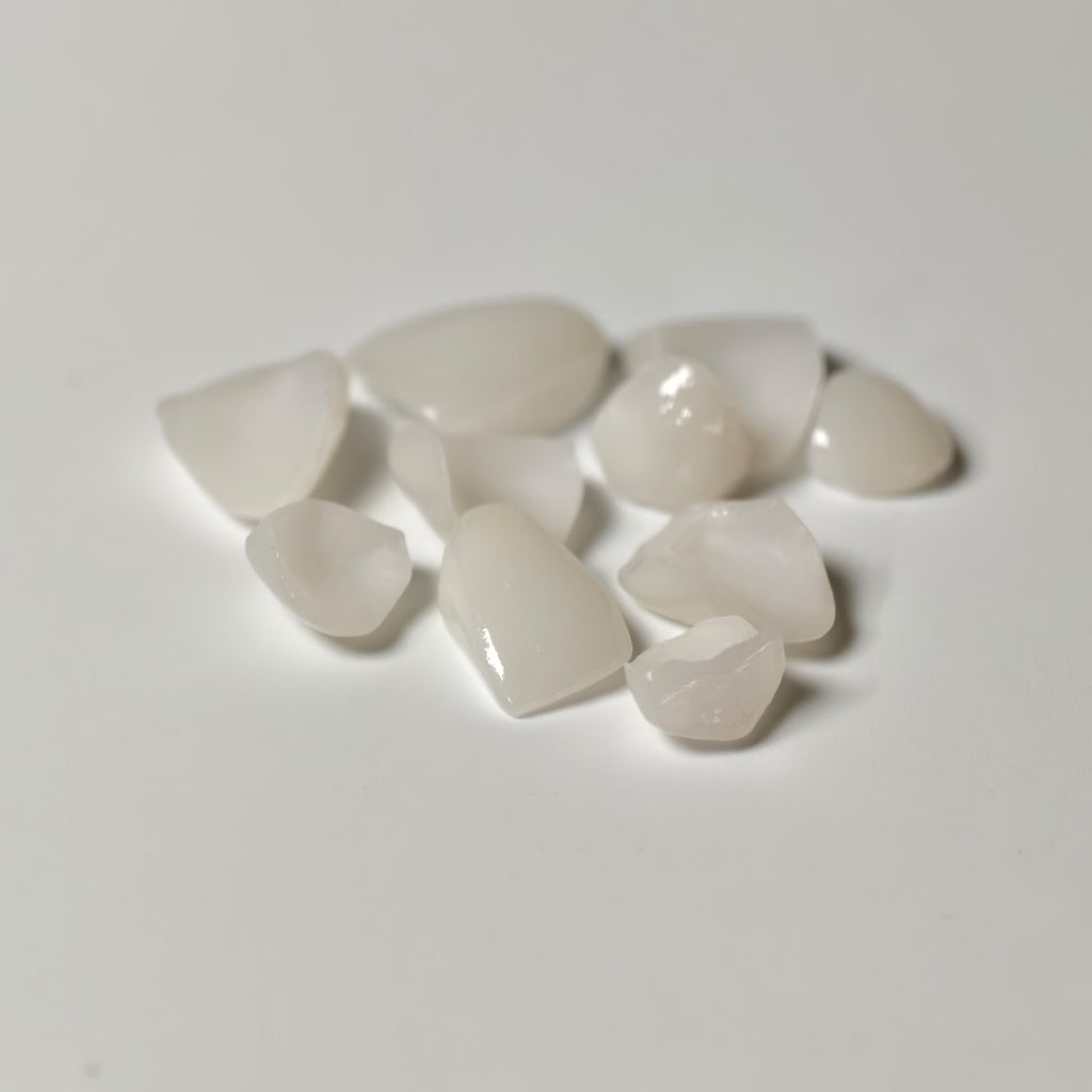 Ultra-Thin Emax Veneer. High Transparency/Translucent, Natural Shade
