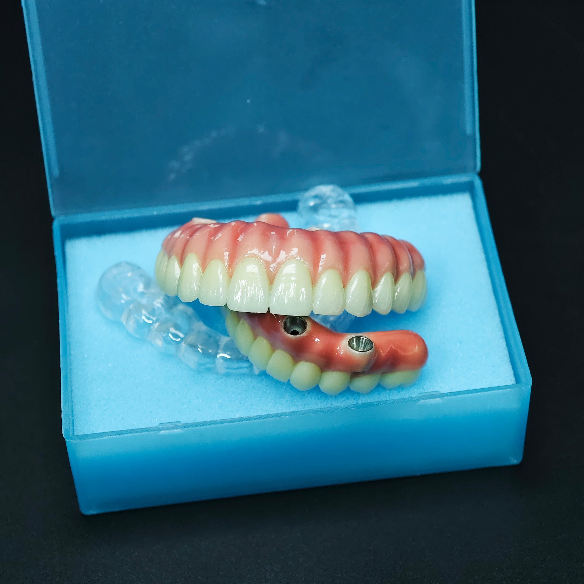 Zirconia-Enamel Hybrid Malo Bridge