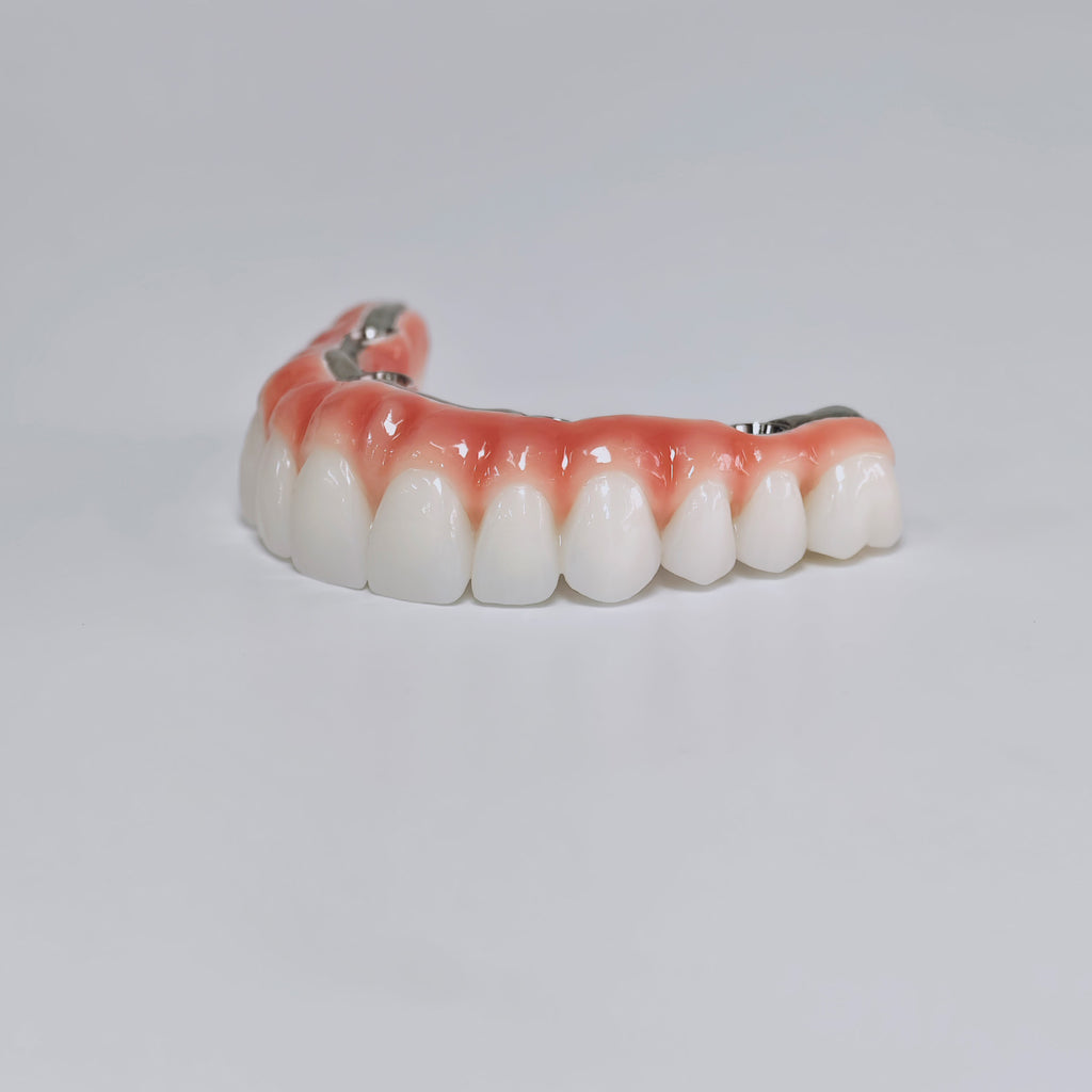 Zirconia-Enamel Hybrid Malo Bridge Aesthetic