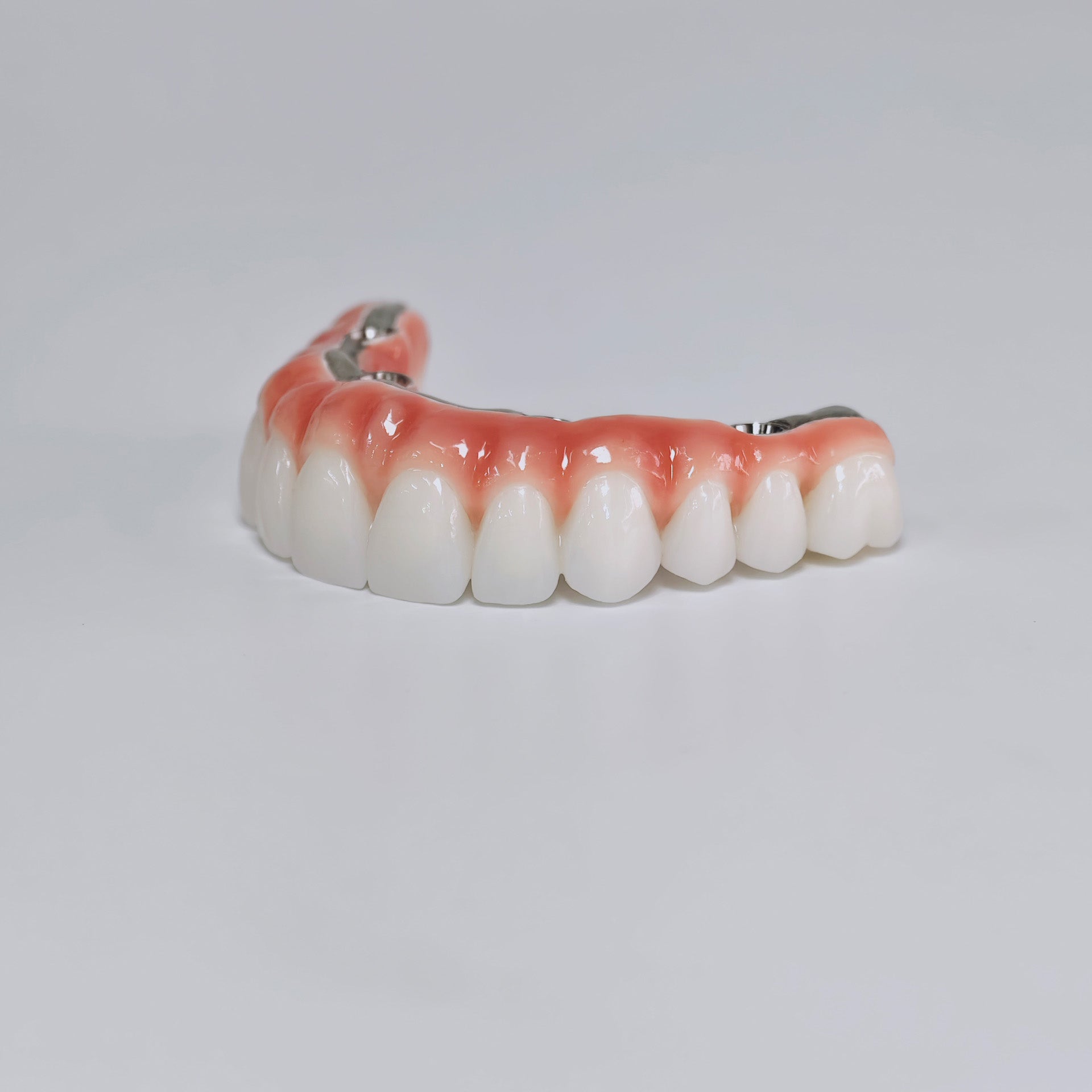 Zirconia-Enamel Hybrid Malo Bridge Aesthetic