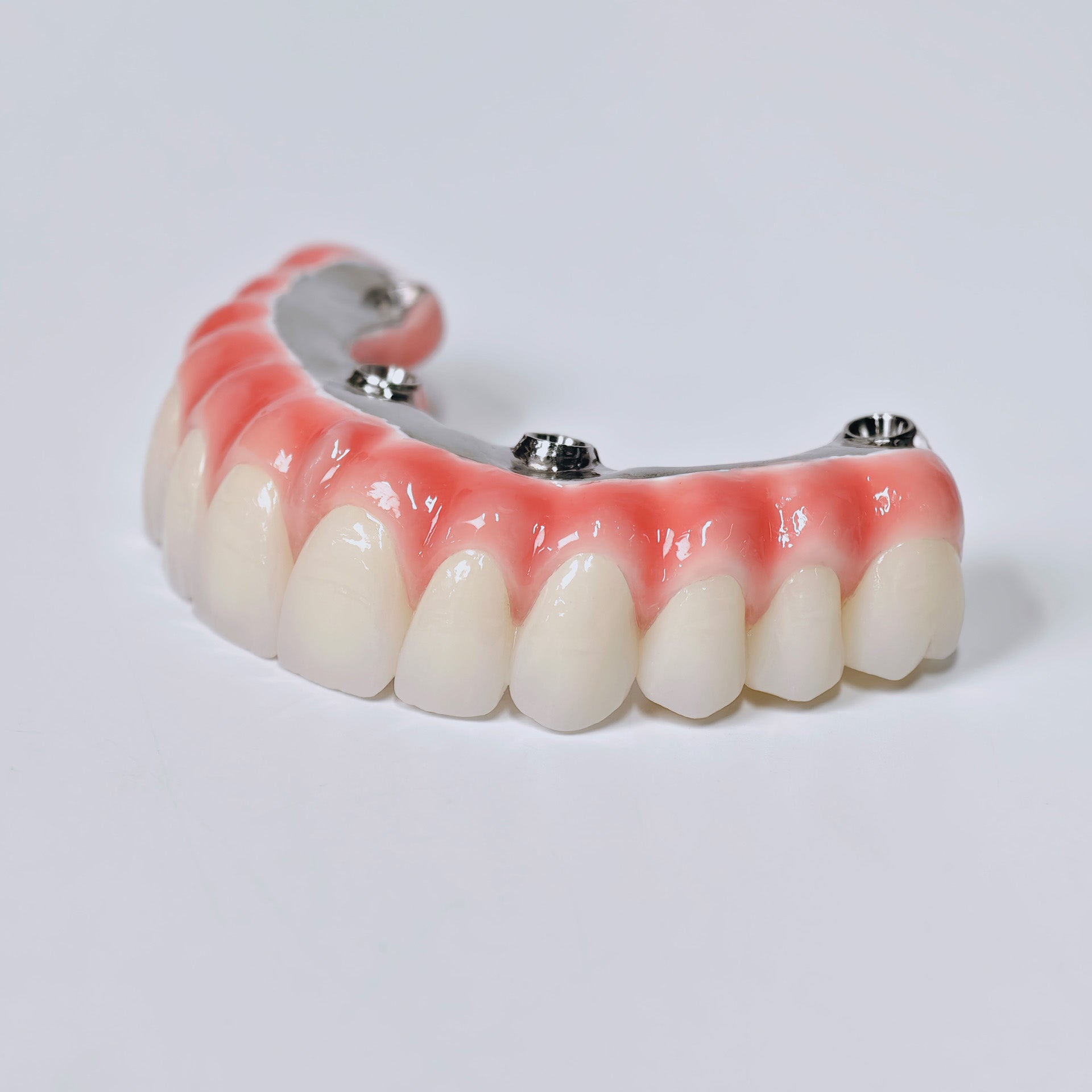 Zirconia-Enamel Hybrid Malo Bridge