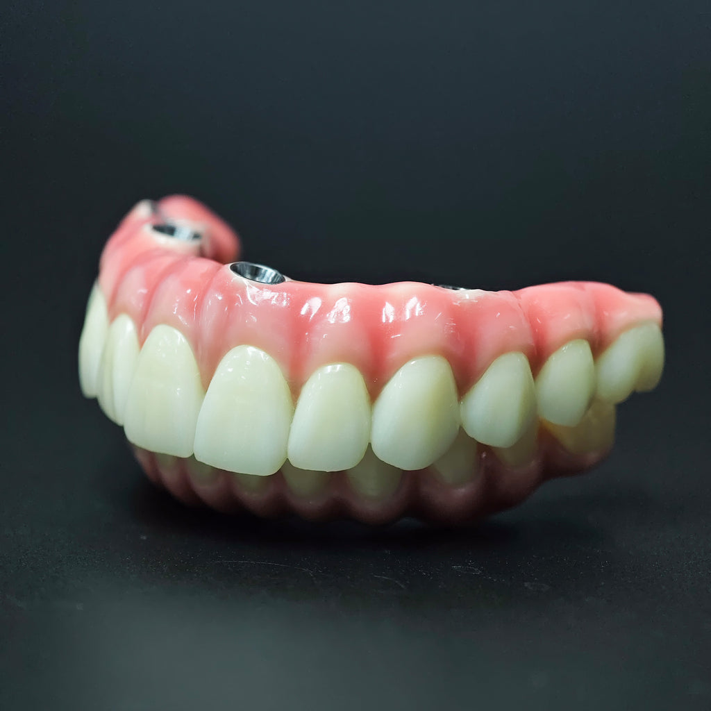 Zirconia-Enamel Hybrid Malo Bridge
