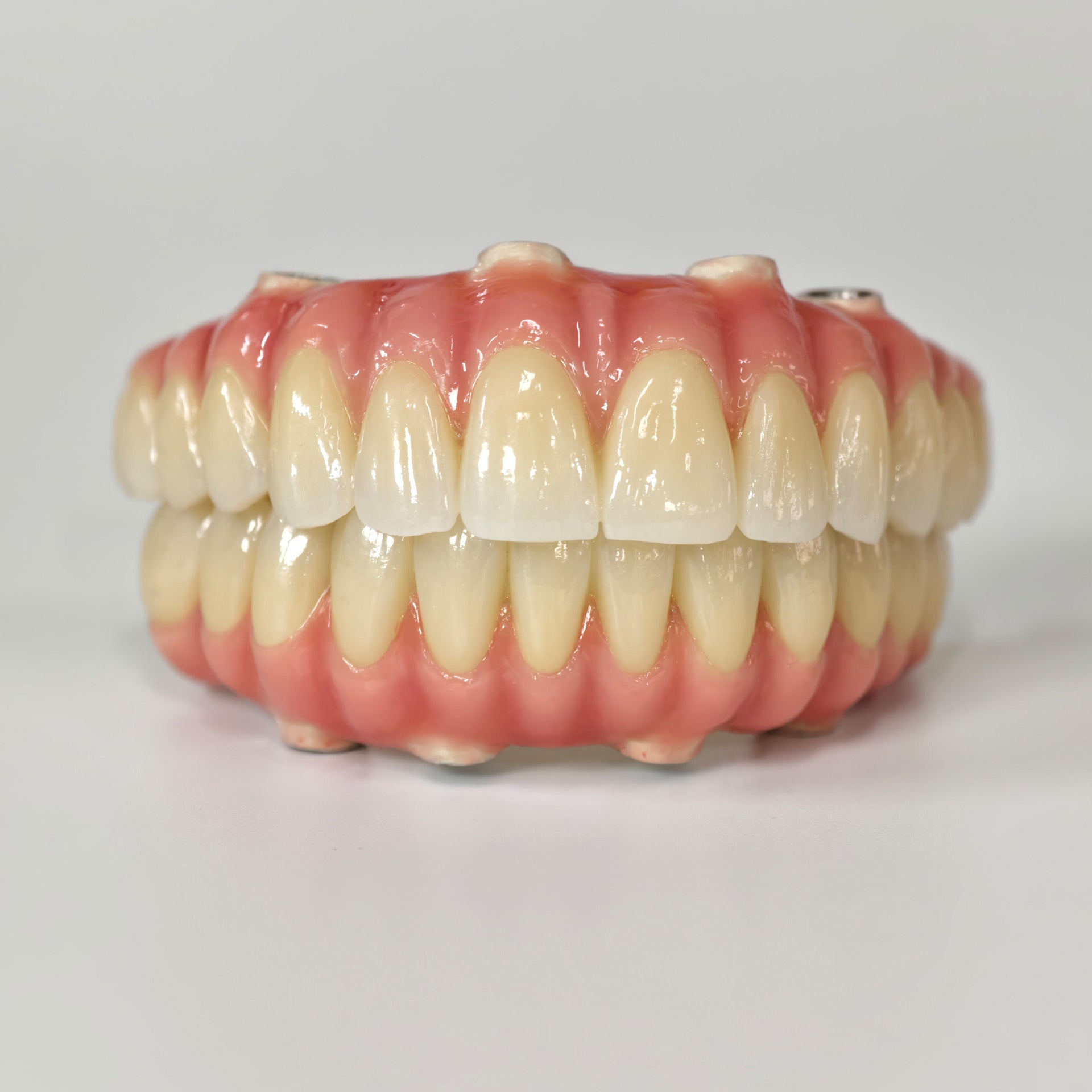 Zirconia-Enamel Hybrid Malo Bridge