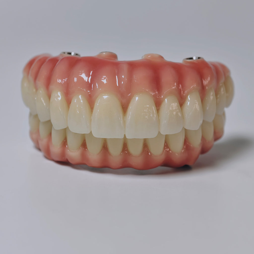 Zirconia-Enamel Hybrid Malo Bridge