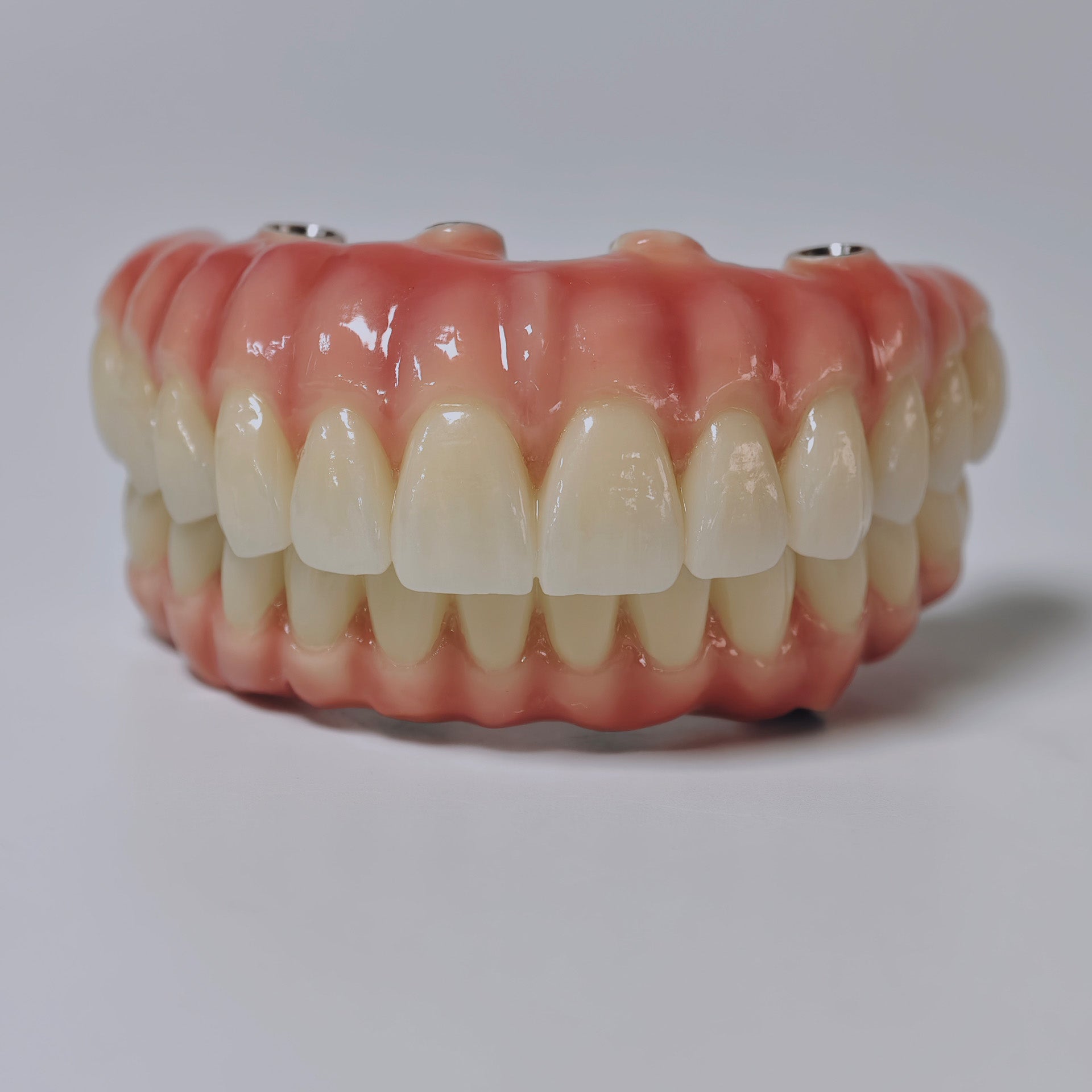 Zirconia-Enamel Hybrid Malo Bridge