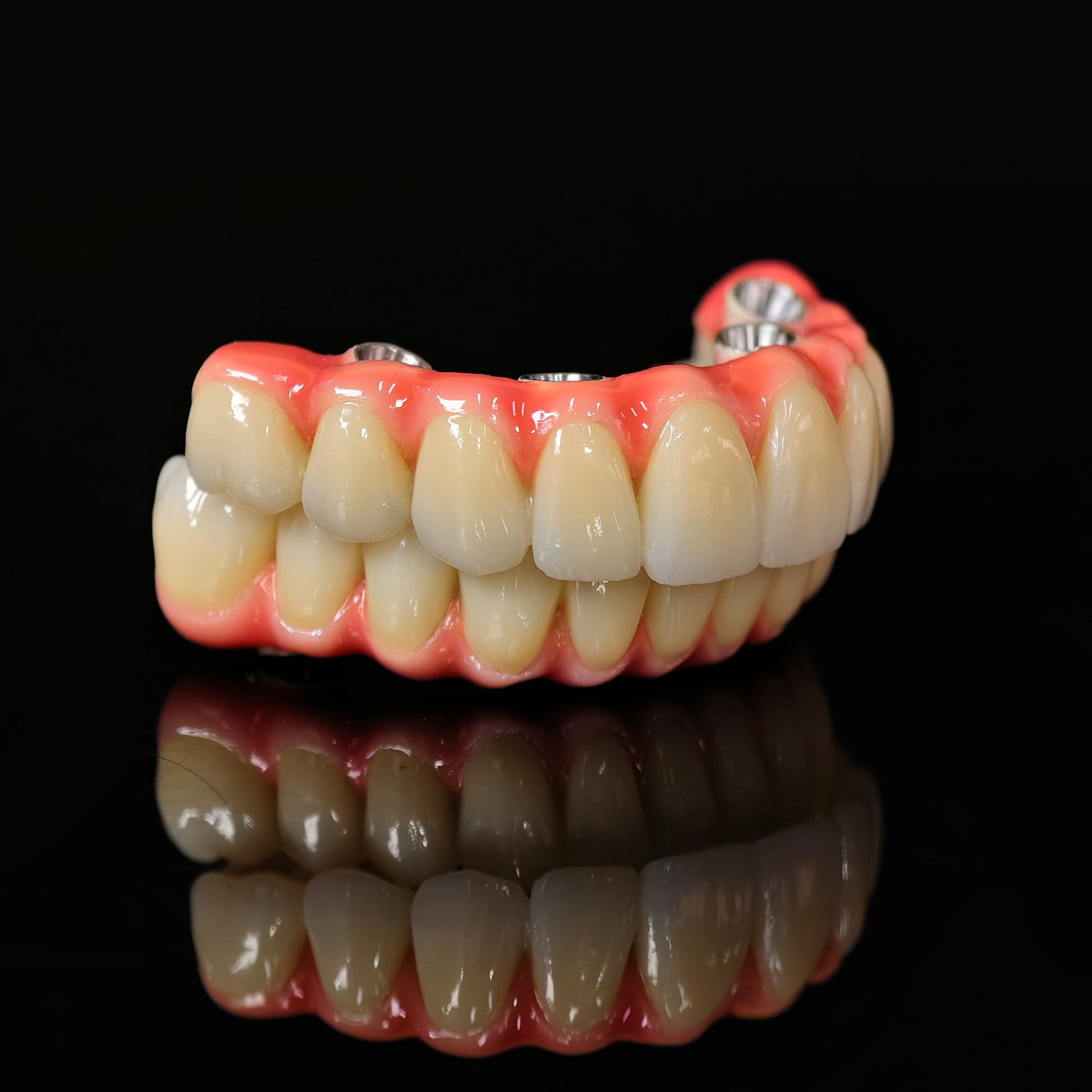 Zirconia-Enamel Hybrid Malo Bridge