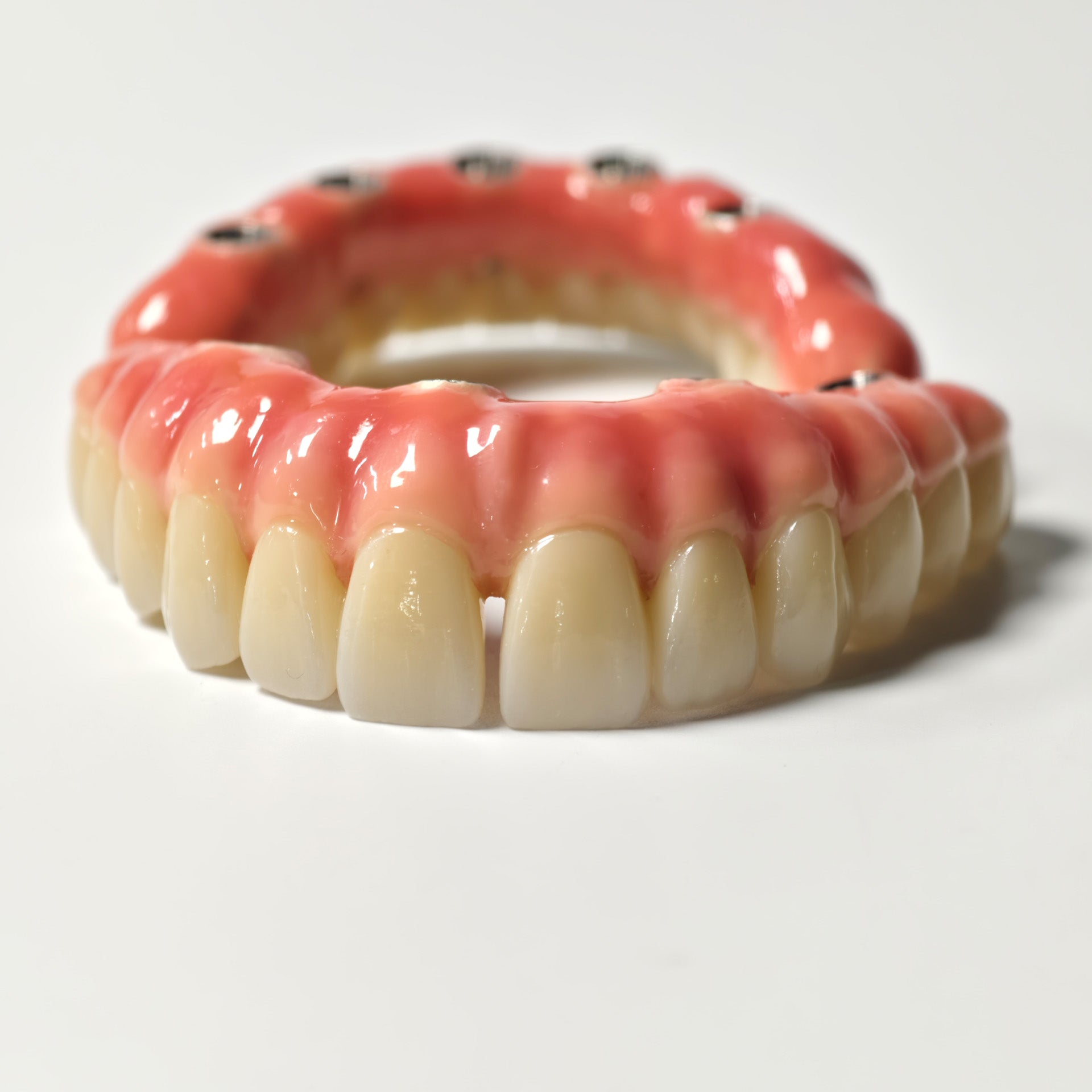 Zirconia-Enamel Hybrid Malo Bridge