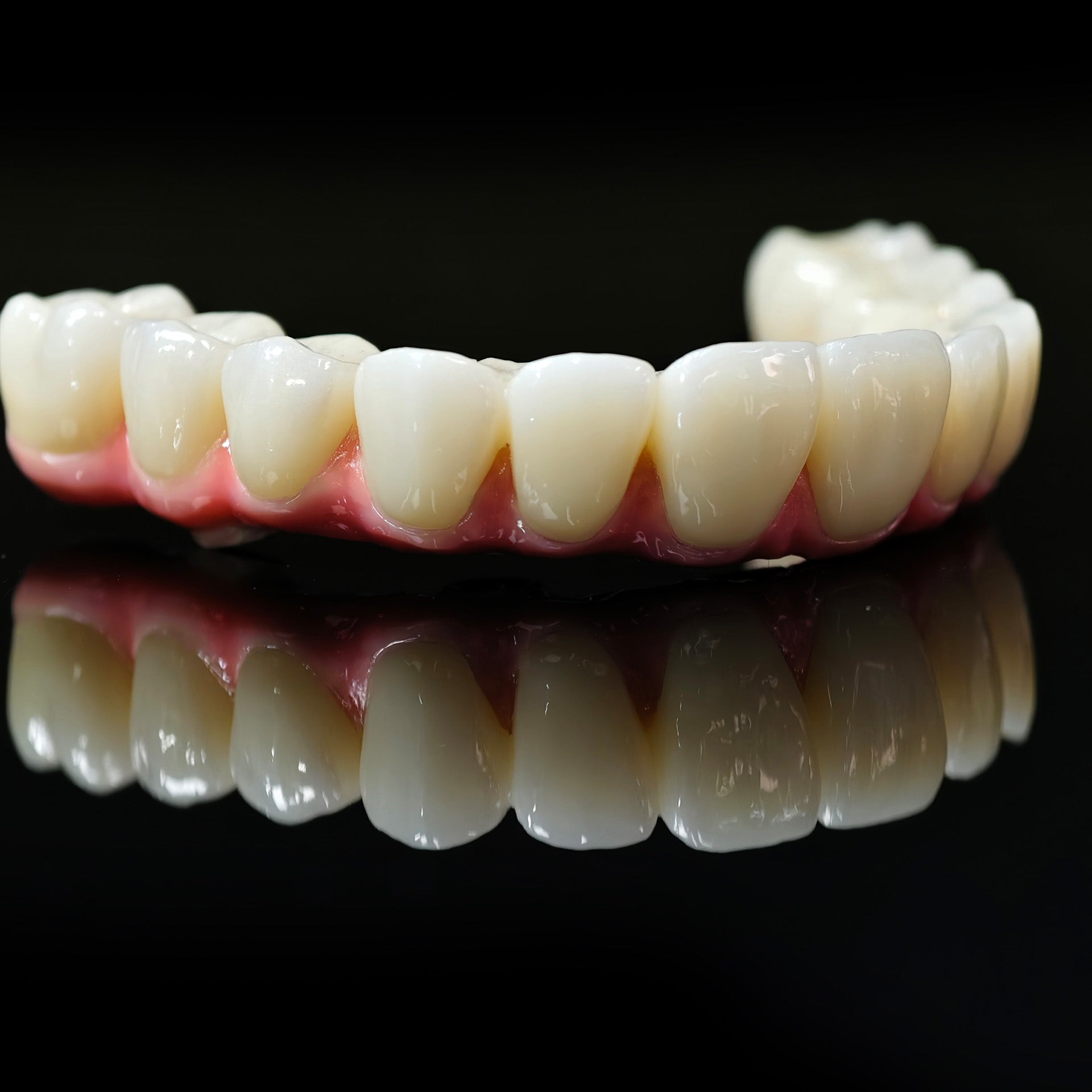 Zirconia-Enamel Hybrid Malo Bridge