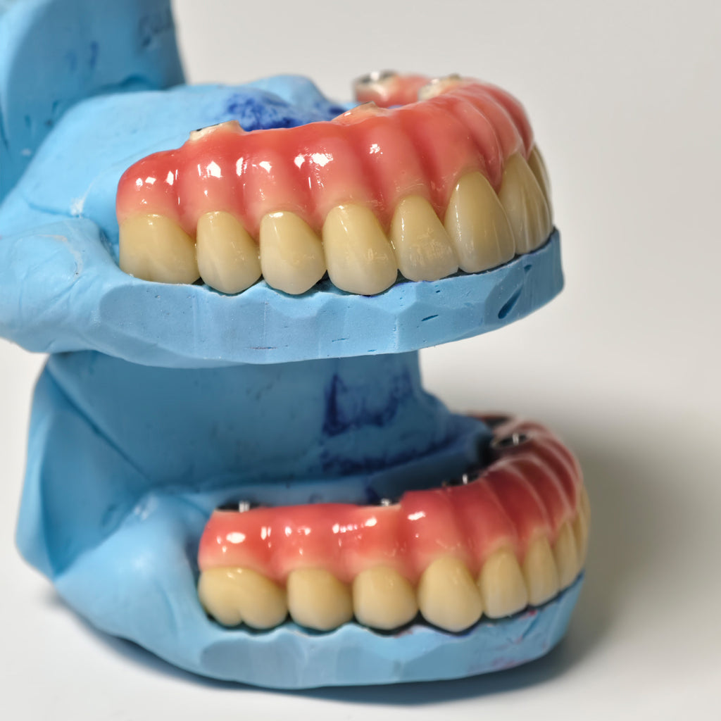 Zirconia-Enamel Hybrid Malo Bridge