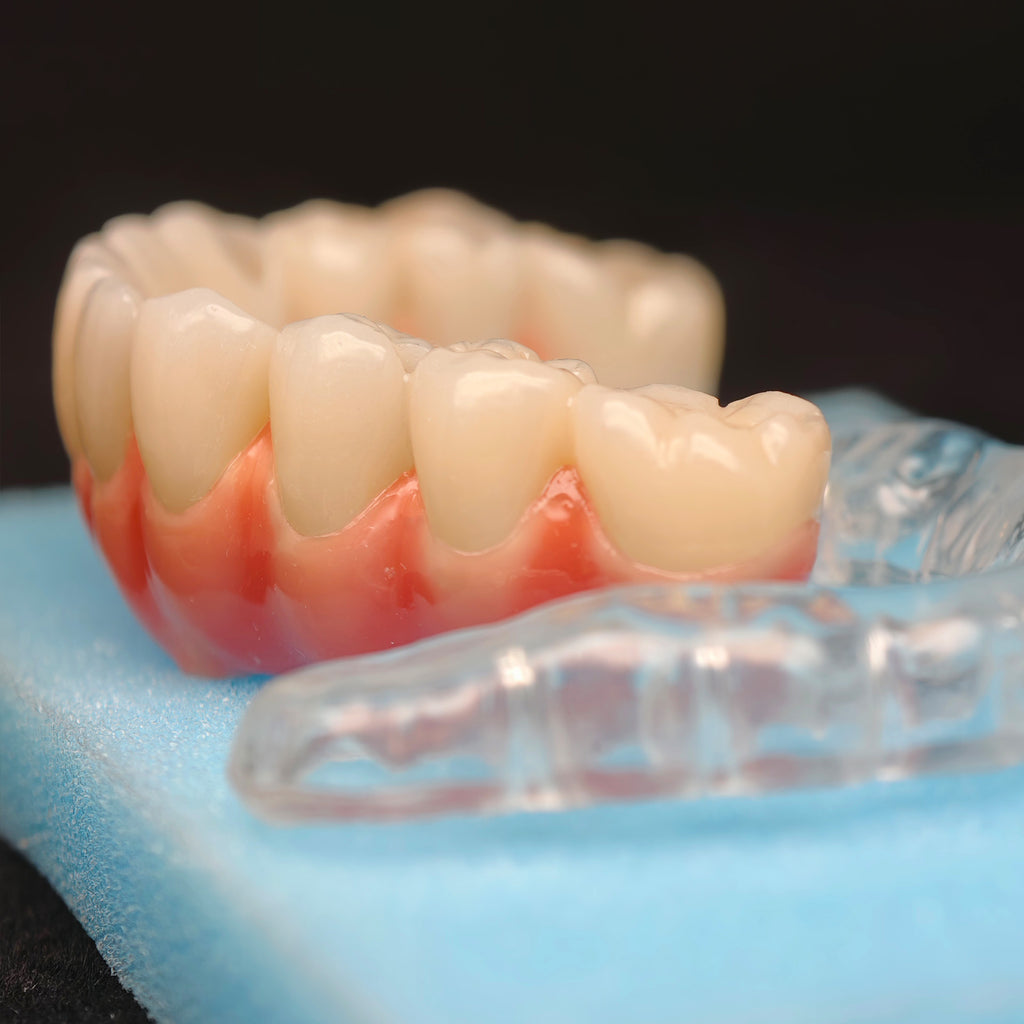 Zirconia-Enamel Hybrid Malo Bridge