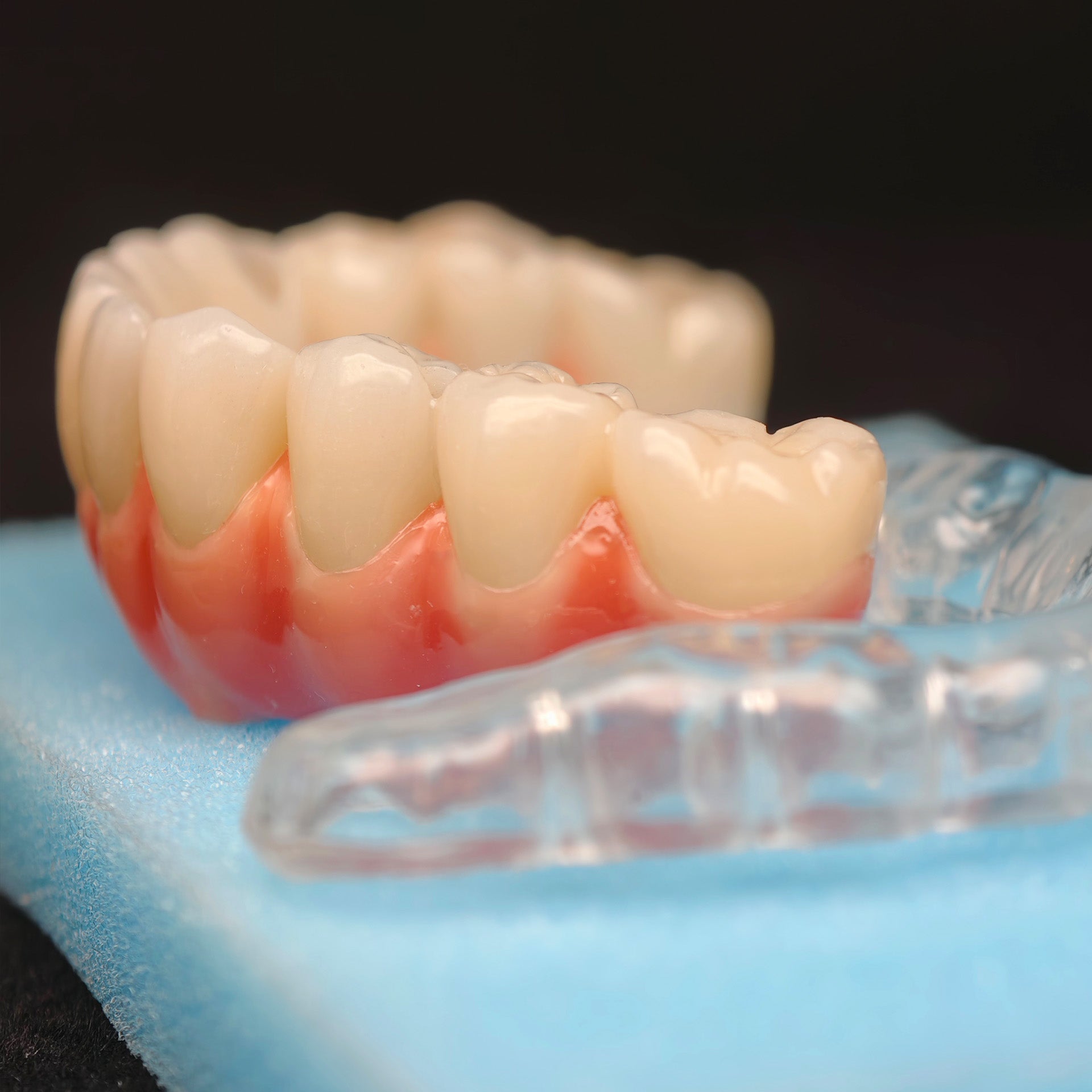 Zirconia-Enamel Hybrid Malo Bridge