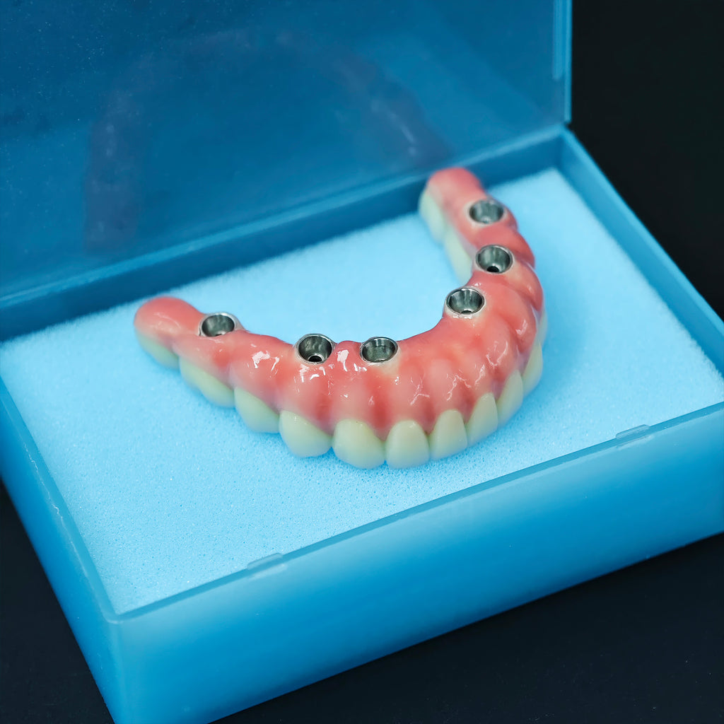 Zirconia-Enamel Hybrid Malo Bridge