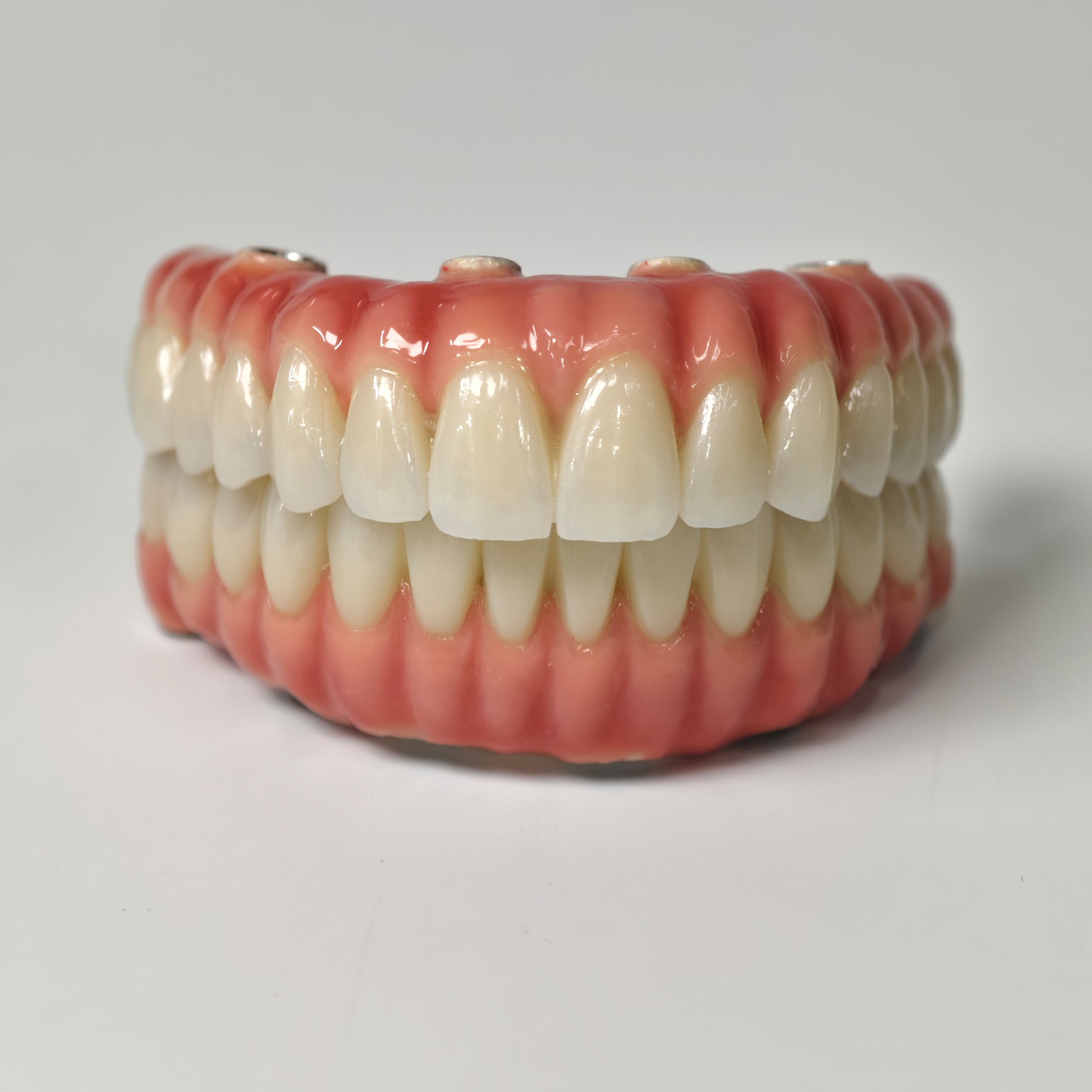 Zirconia-Enamel Hybrid Malo Bridge