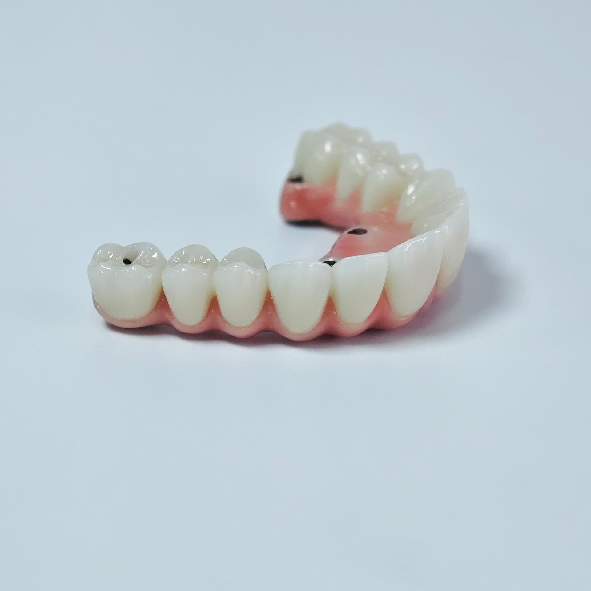 Zirconia-Enamel Hybrid Malo Bridge
