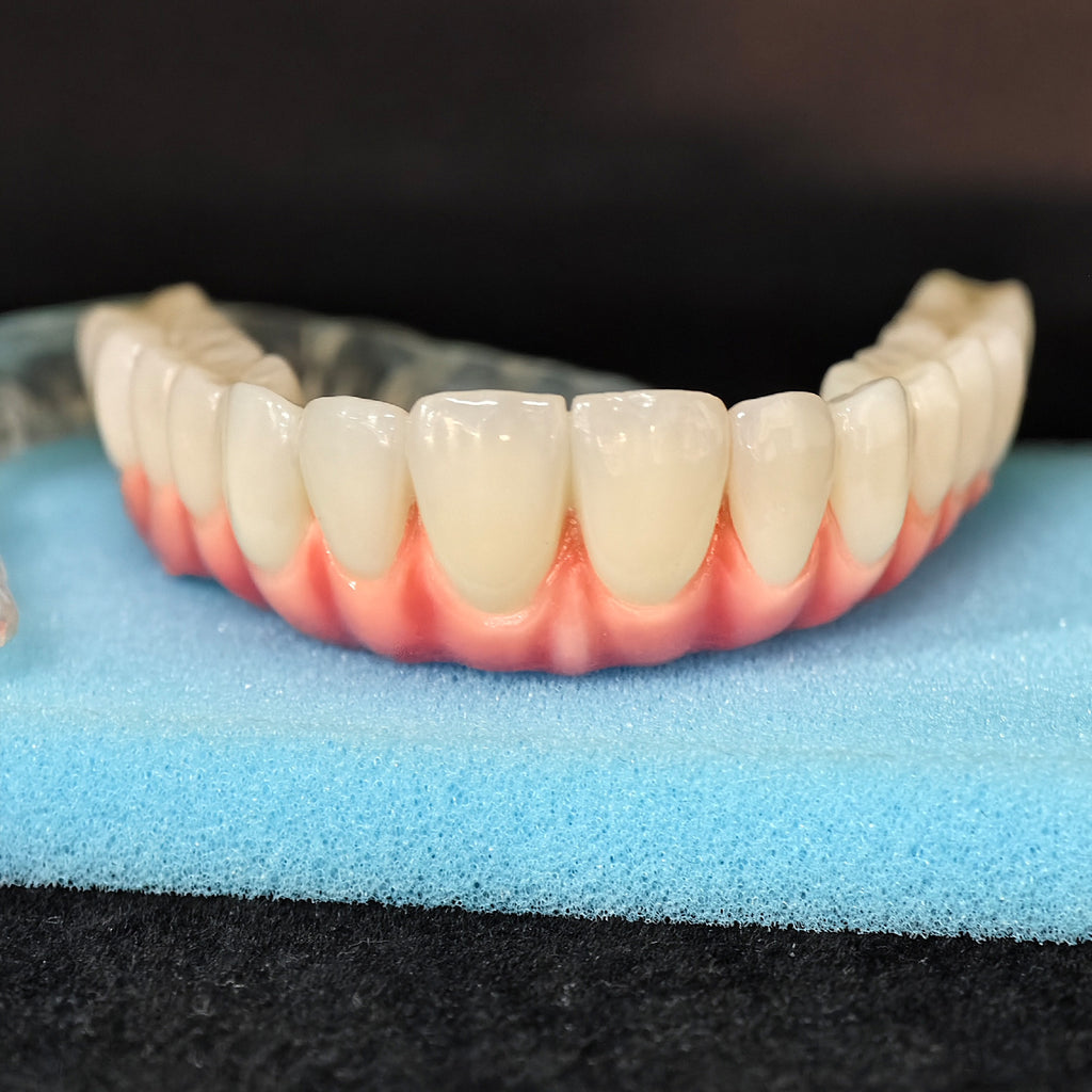Zirconia-Enamel Hybrid Malo Bridge