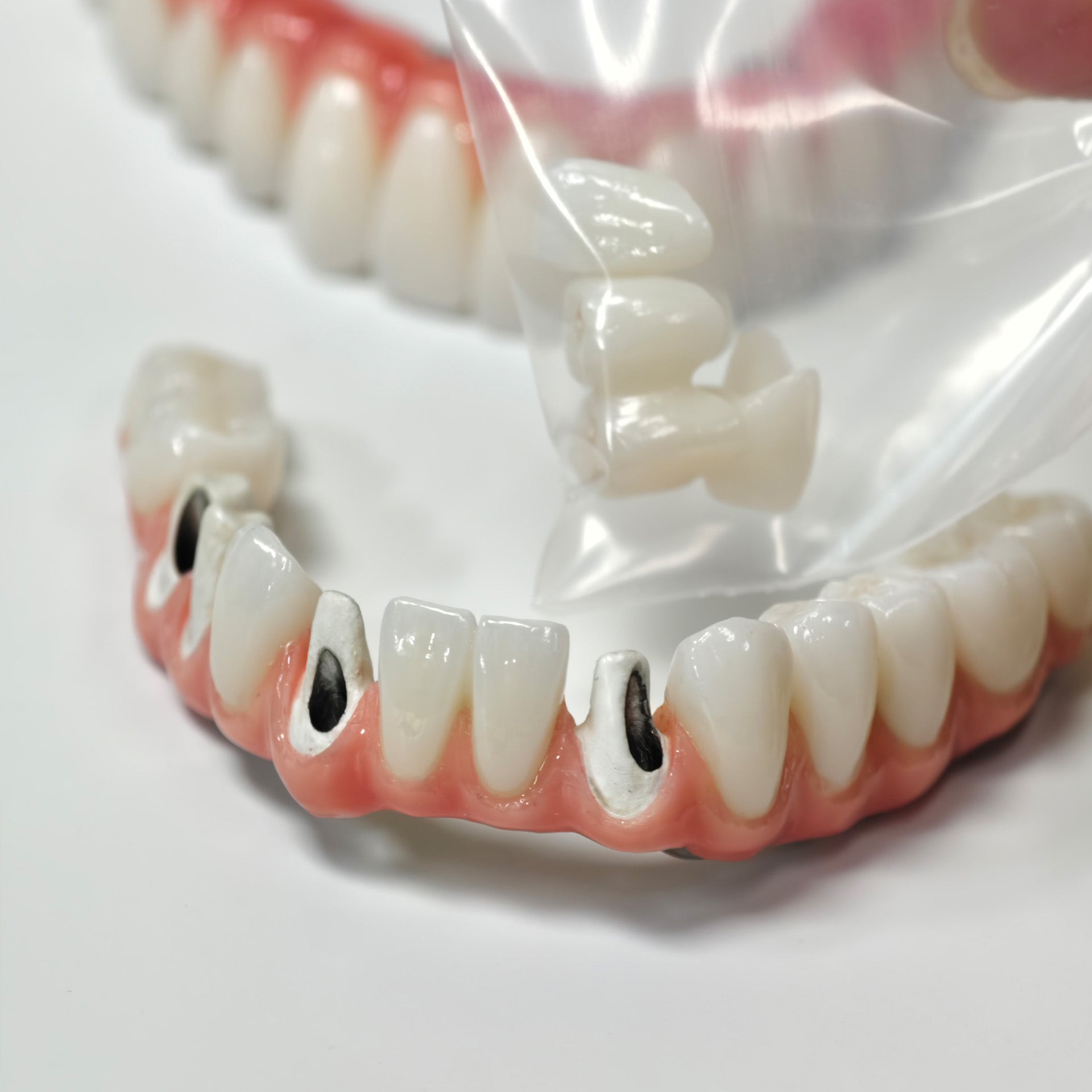 Zirconia-Enamel Hybrid Malo Bridge