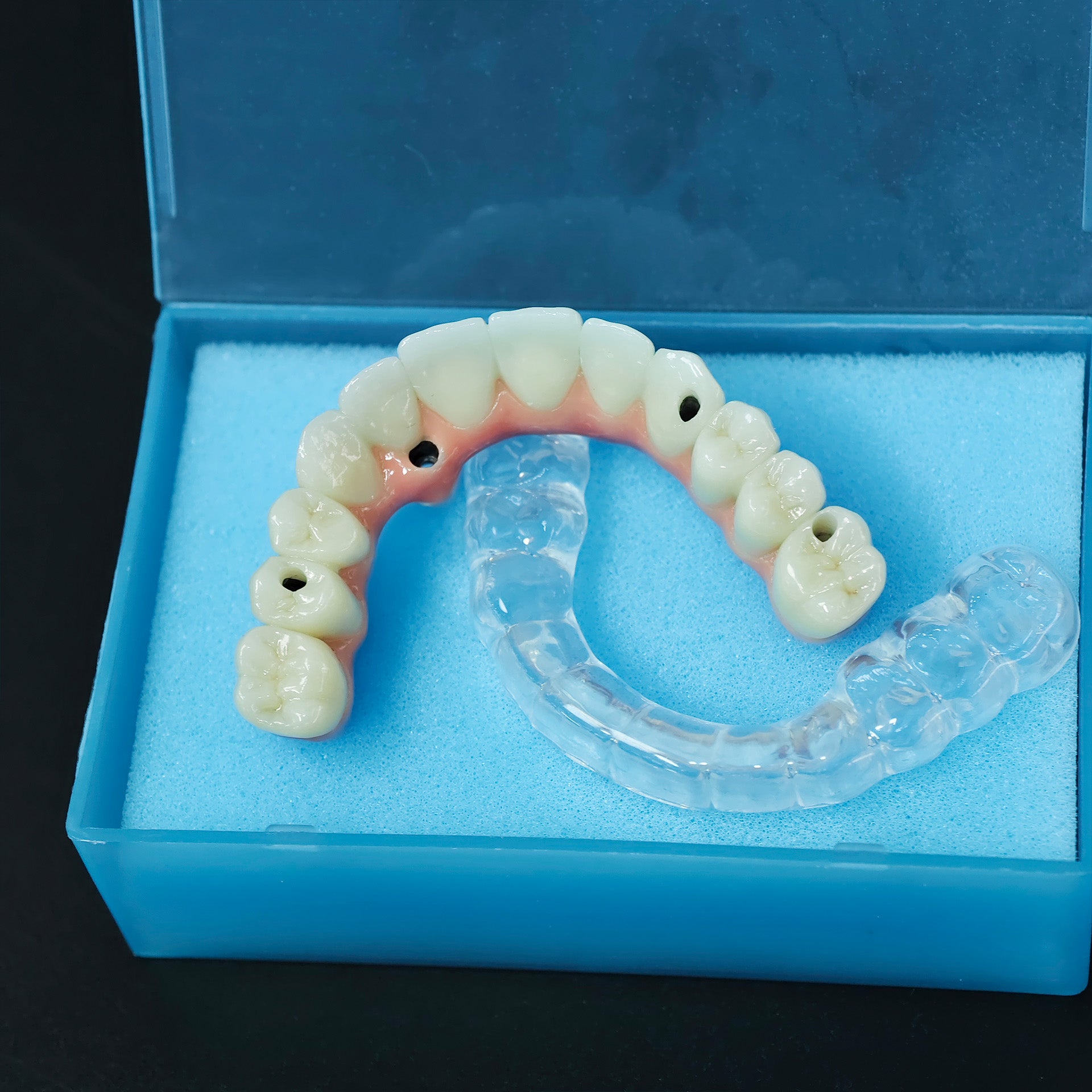 Zirconia-Enamel Hybrid Malo Bridge