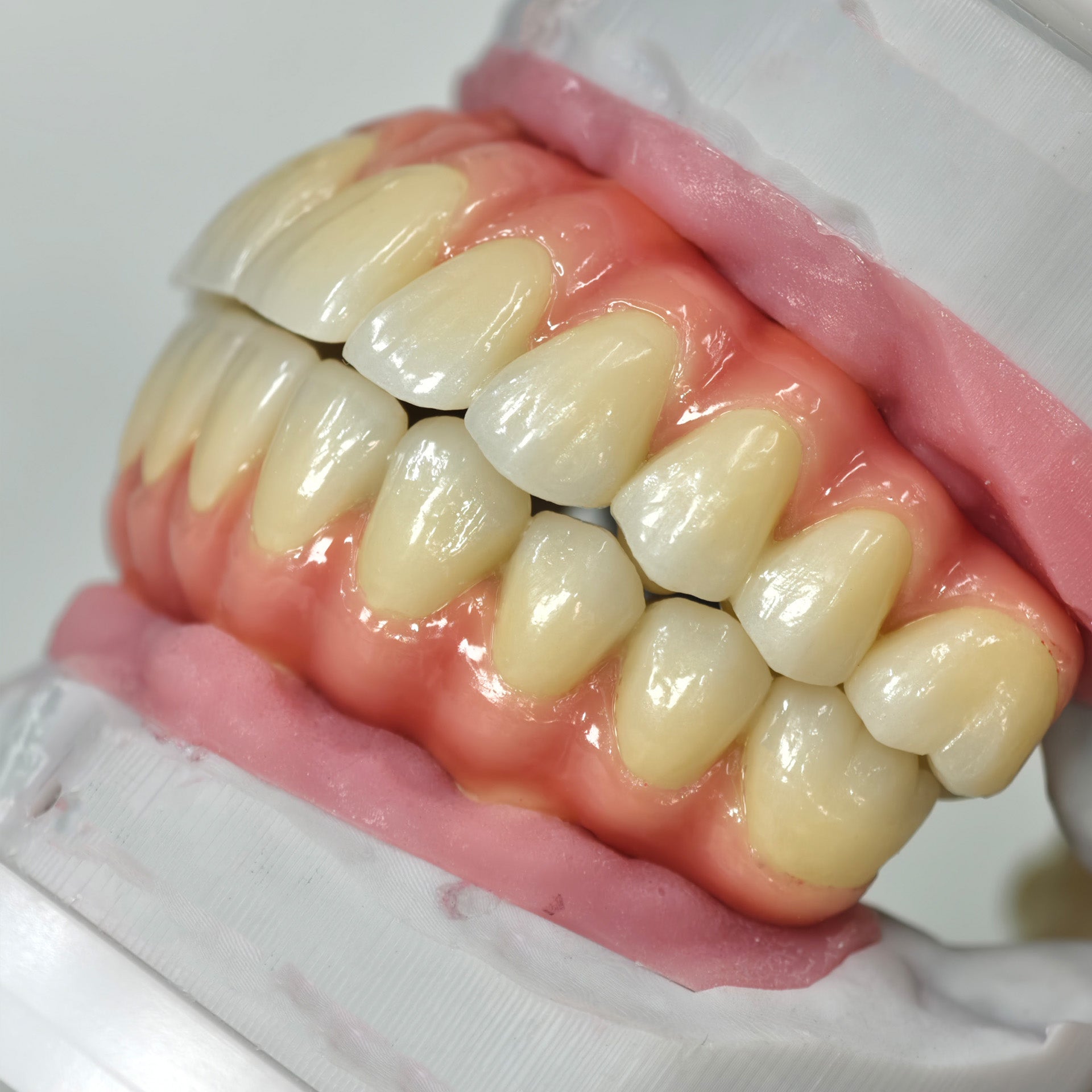 Zirconia-Enamel Hybrid Malo Bridge