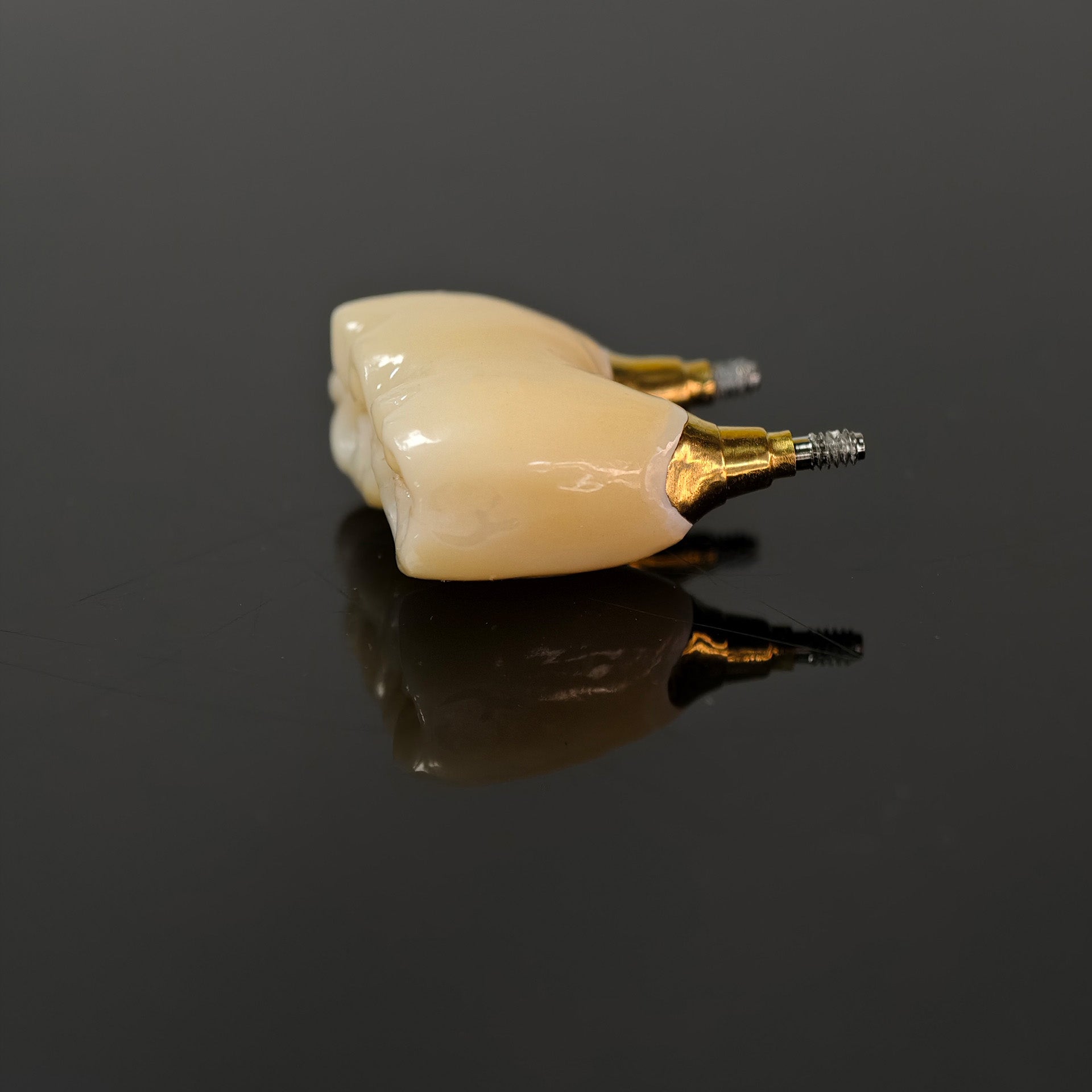 Zirconia Bridge With Screw Retained
