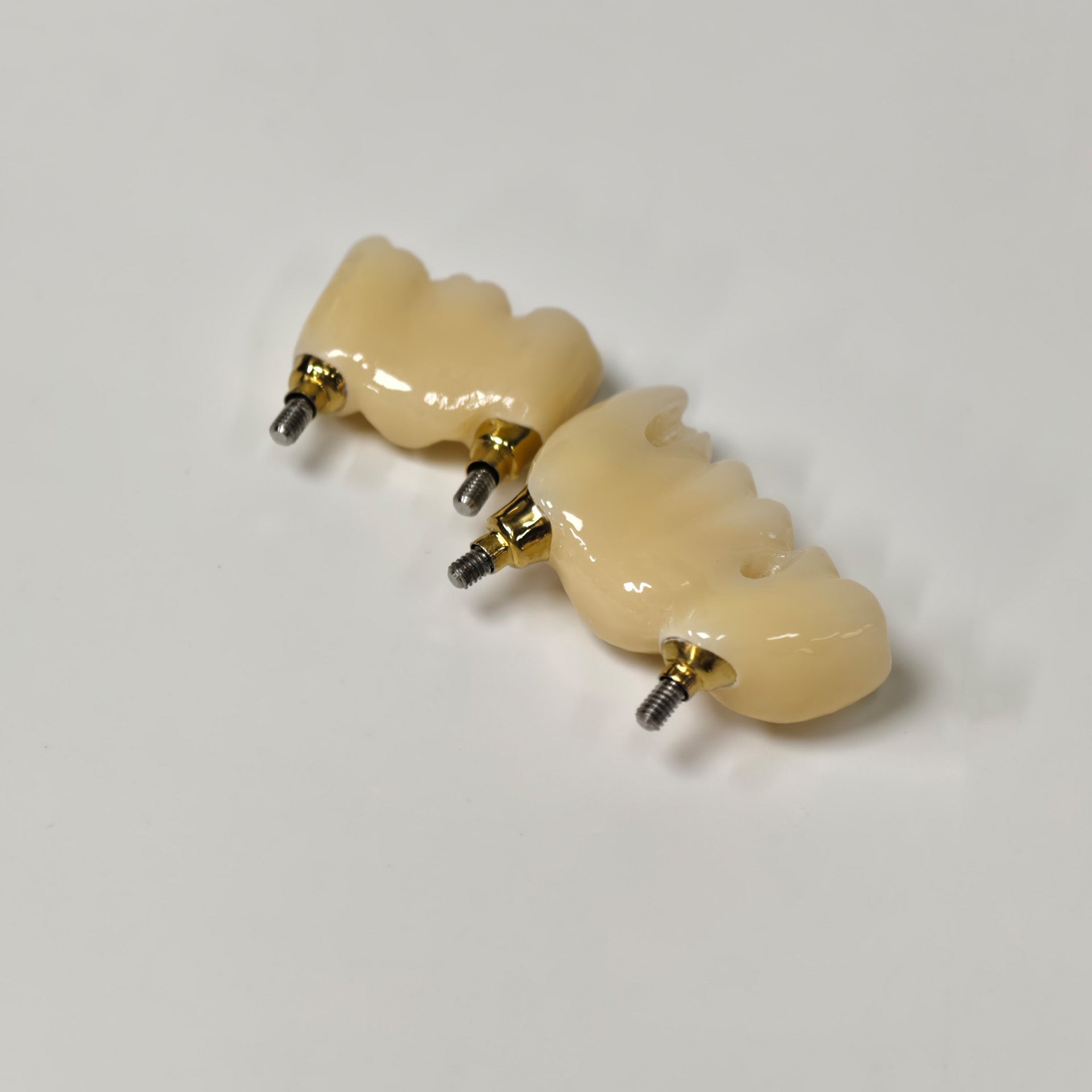 Zirconia Bridges With Screw Retained