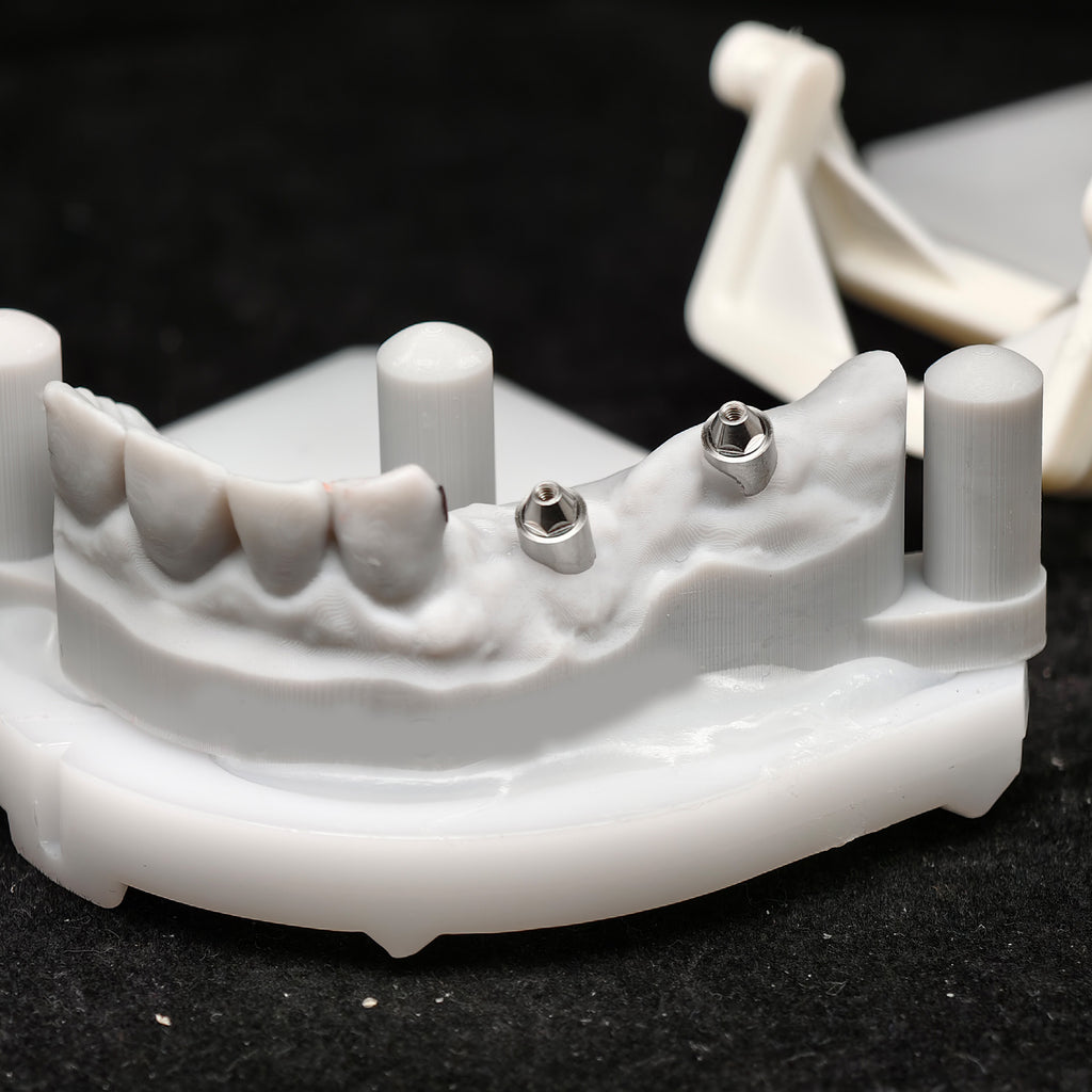 Zirconia Bridge With Ti-Base Screw Retained