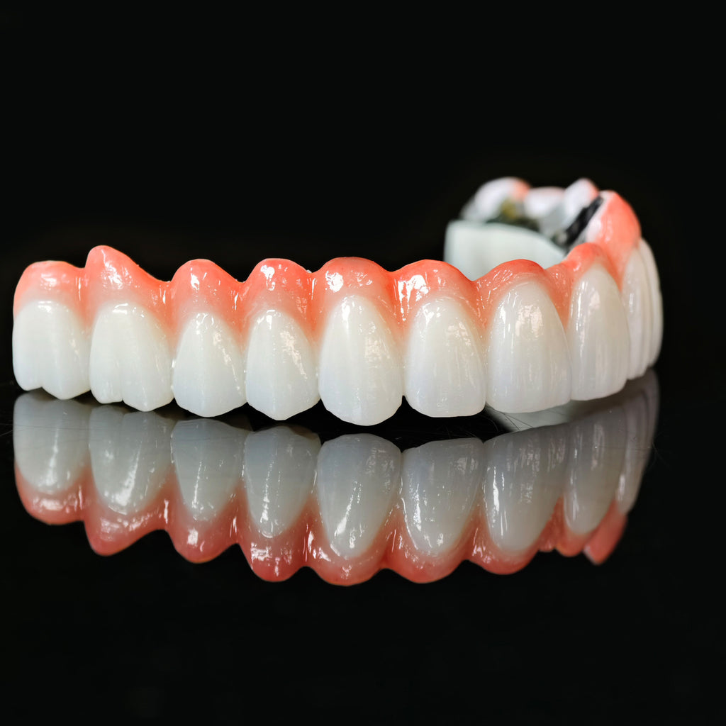 Zirconia Bridge With Cement Retained And Titanium Bar