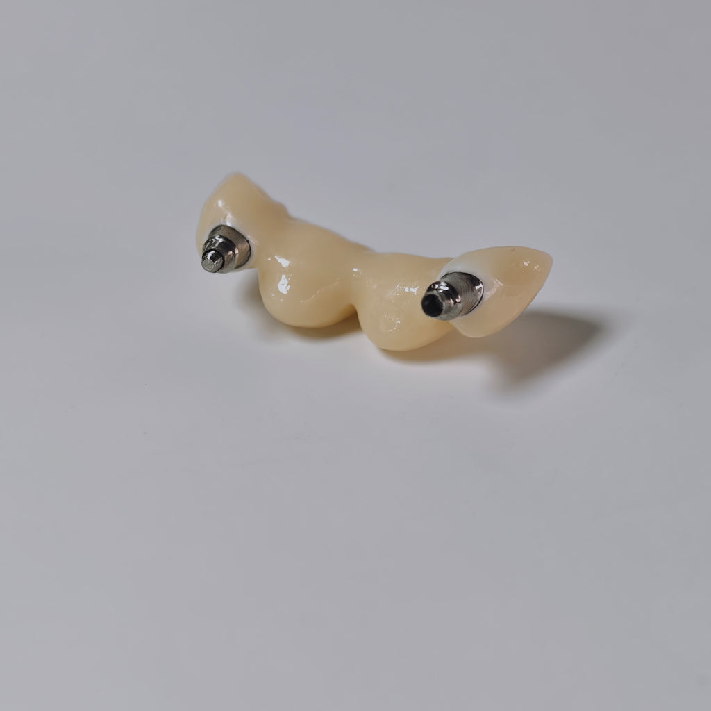 Zirconia Bridge With Screw Retained