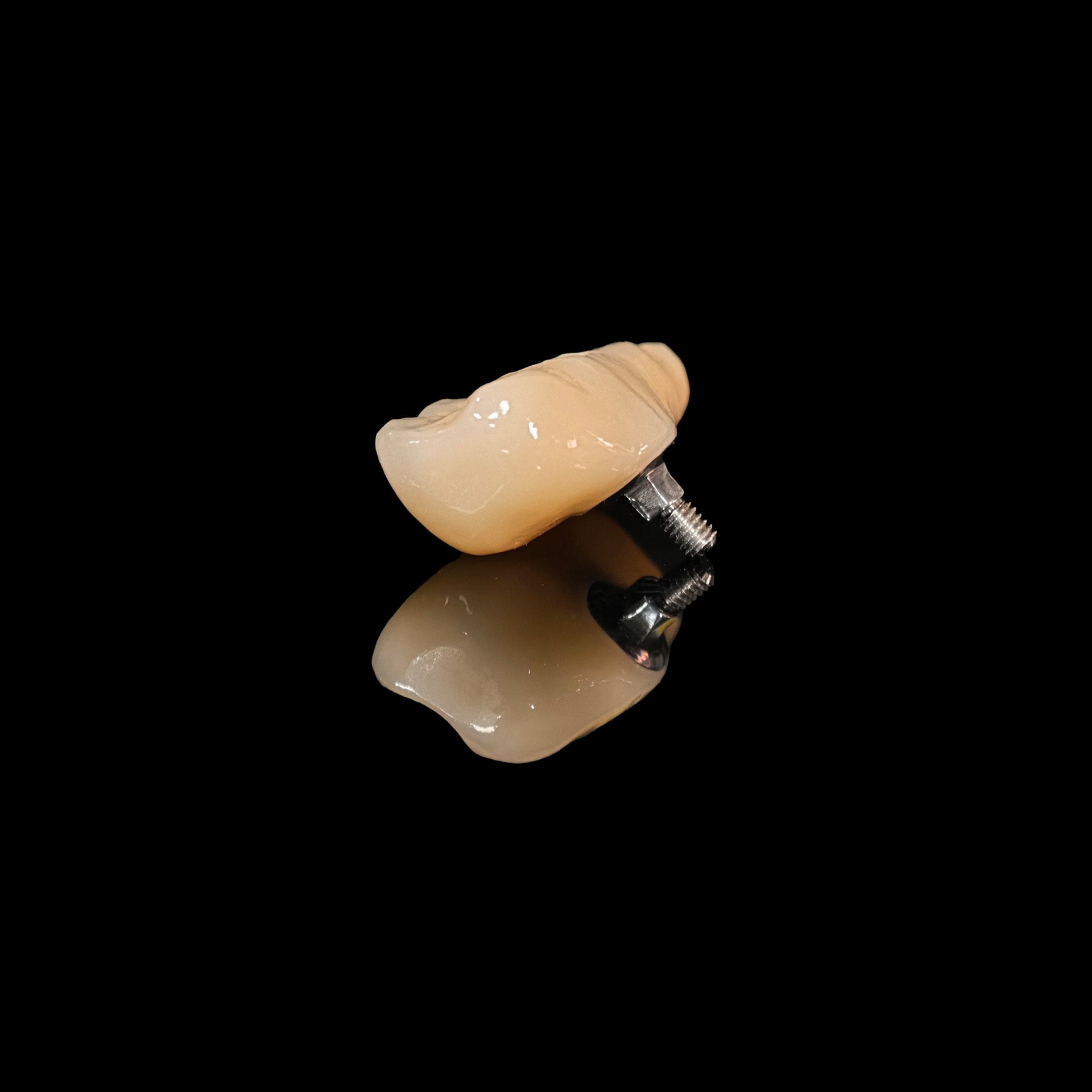 Zirconia Bridge With Screw Retained