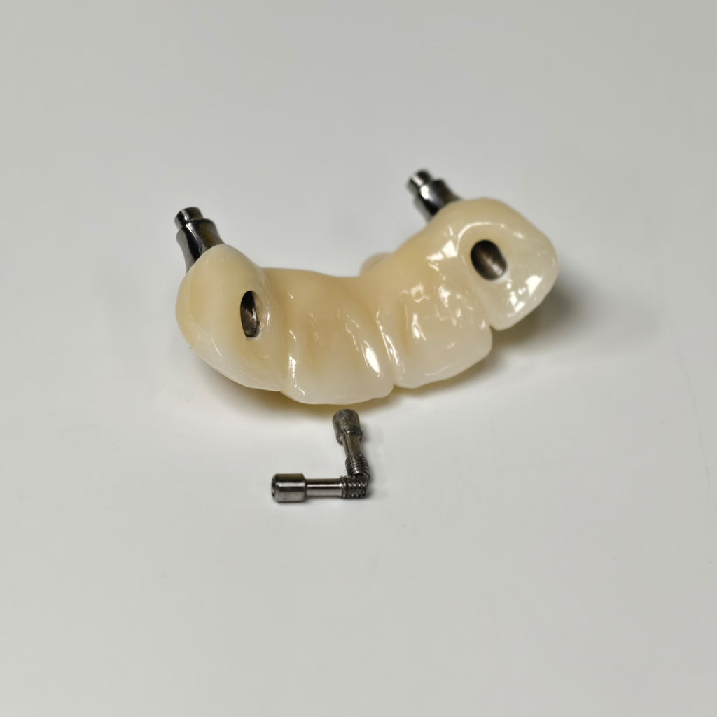 Zirconia Bridge With Screw Retained