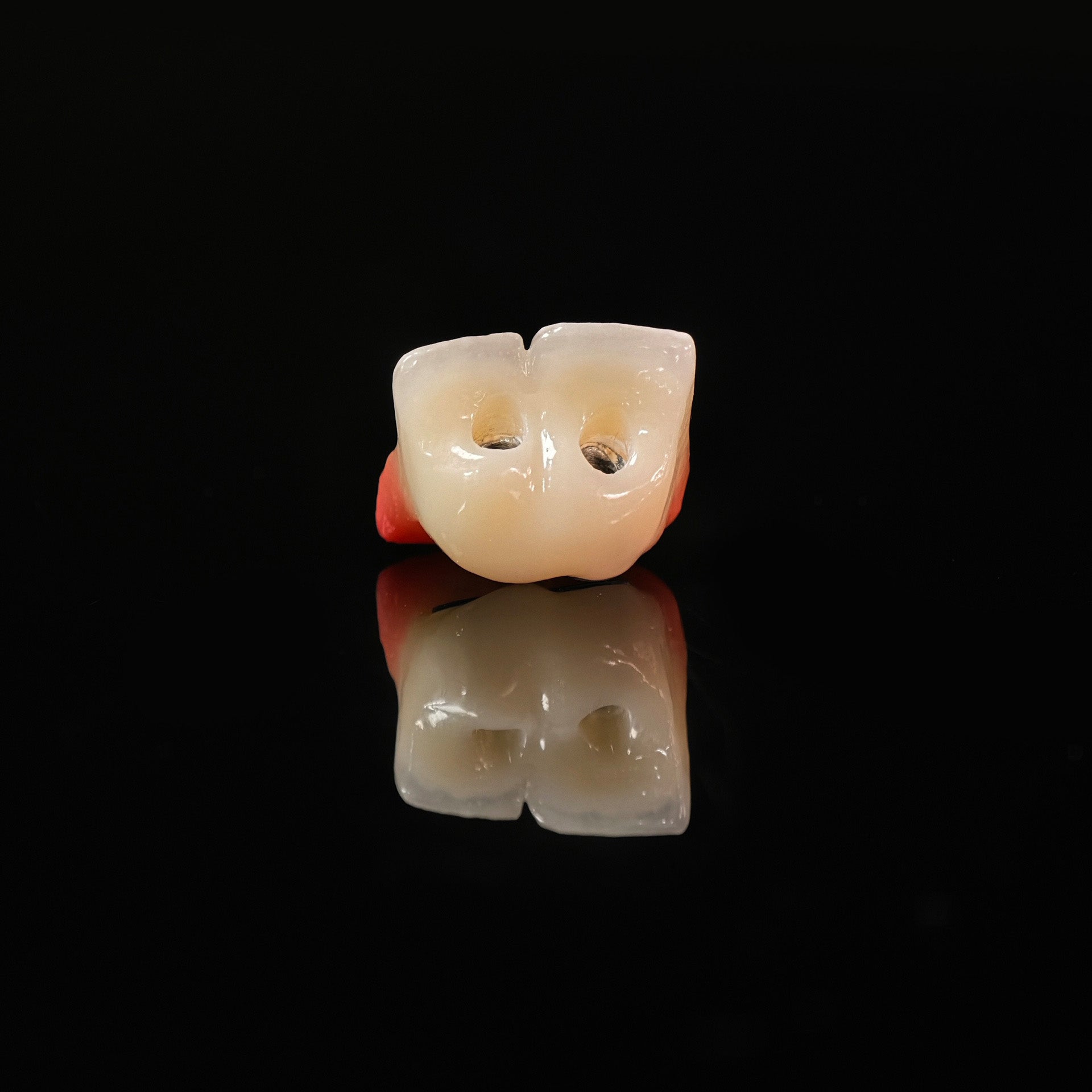 Zirconia Bridge With Ti-Base Bautment