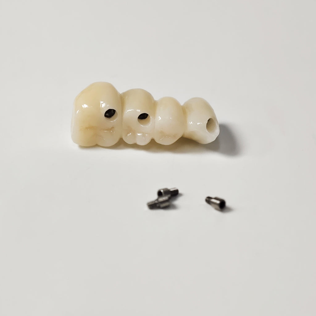 Zirconia Bridge With Ti-Base Screw Retained