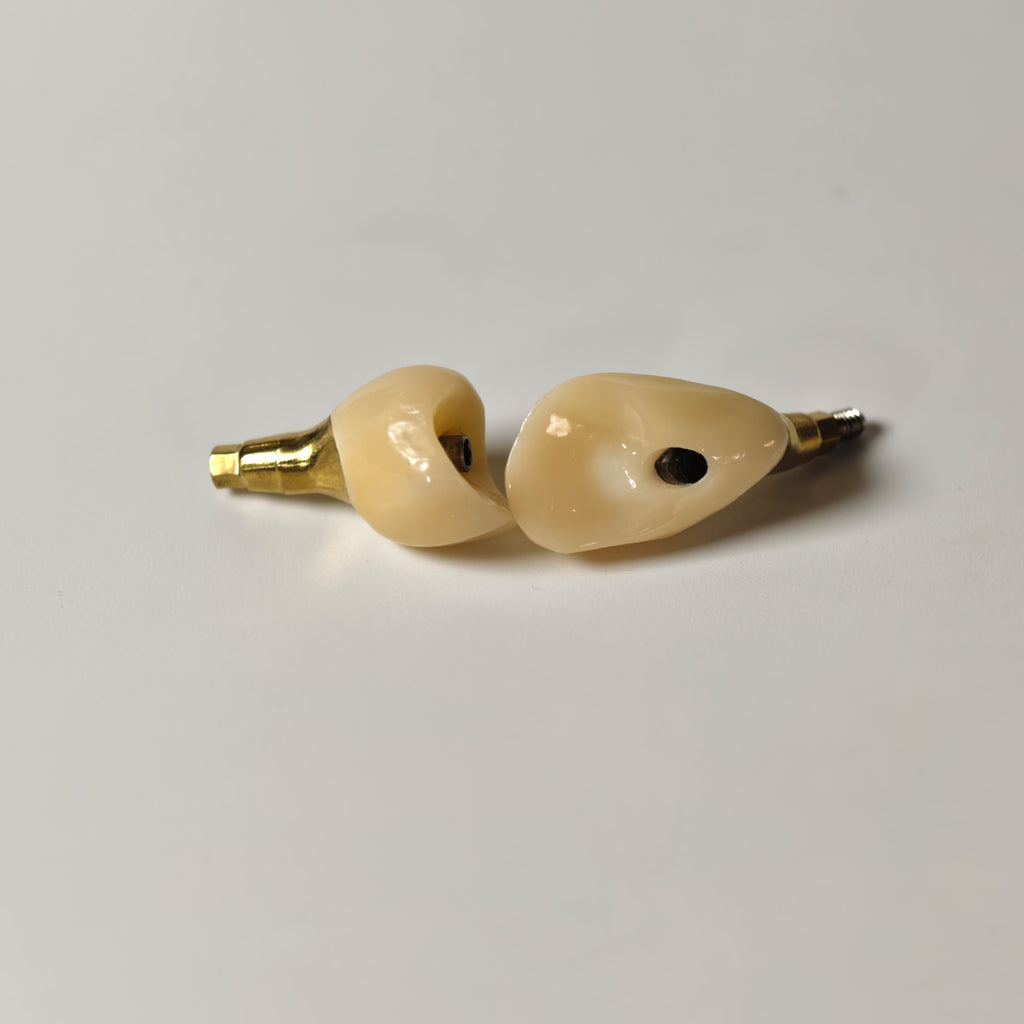 Zirconia Crowns With Gold-Plated Abutment