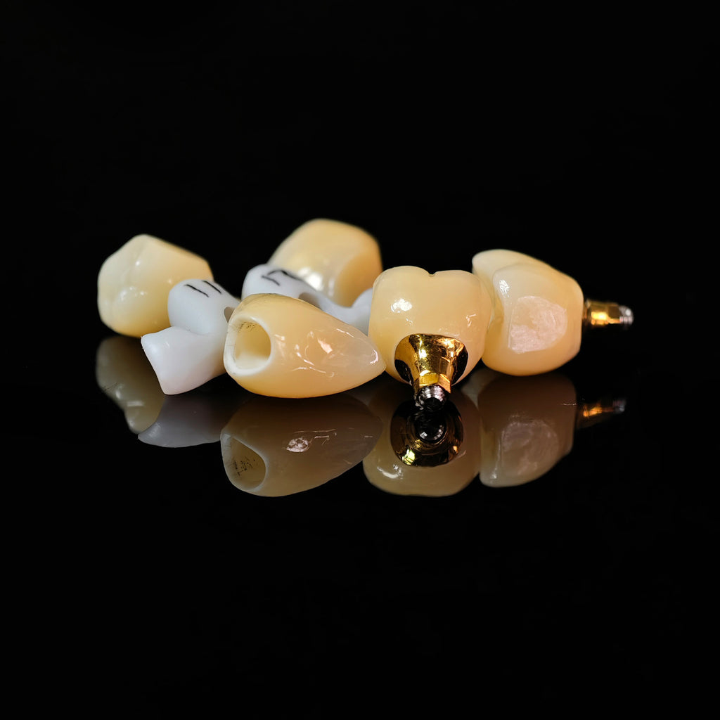 Zirconia Crowns With Gold-Plated Abutment And Implant Seating Guide