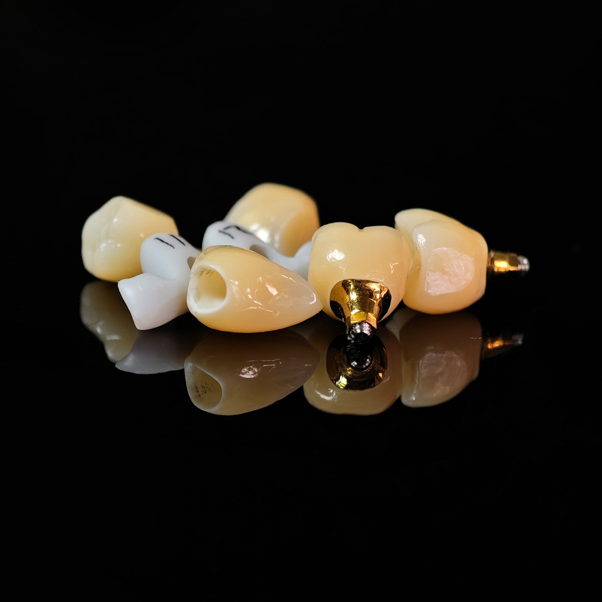 Zirconia Crowns With Gold-Plated Abutment And Implant Seating Guide
