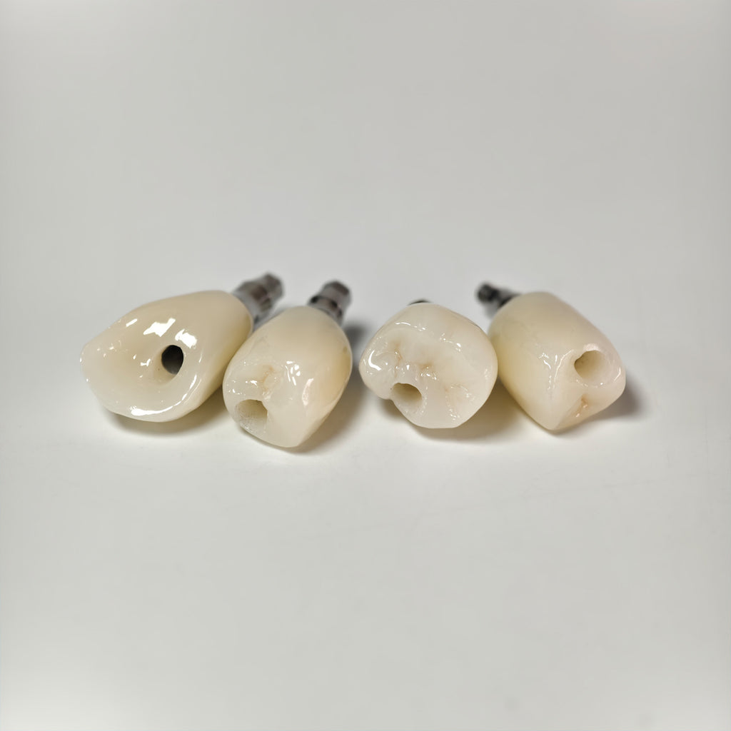 Zirconia Crowns With Screw Retained