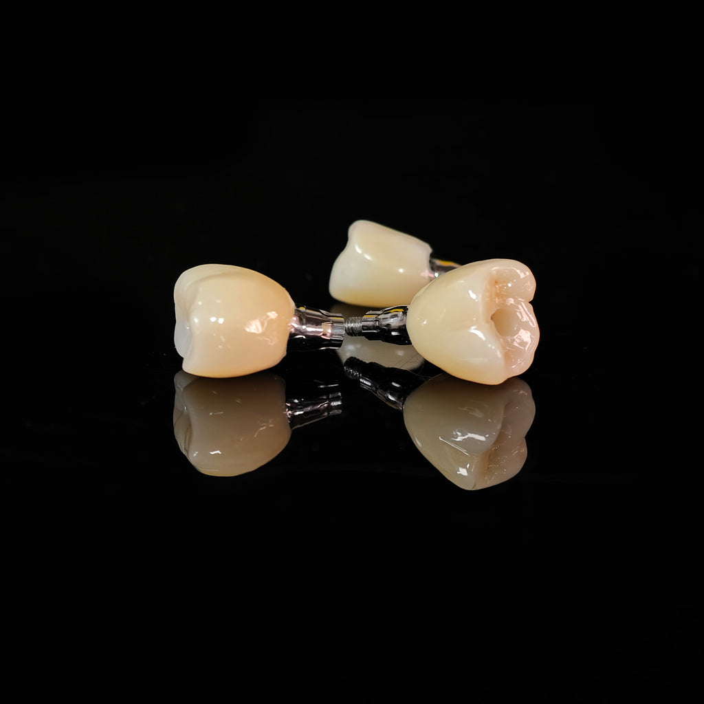 Zirconia Crowns With Screw Retained