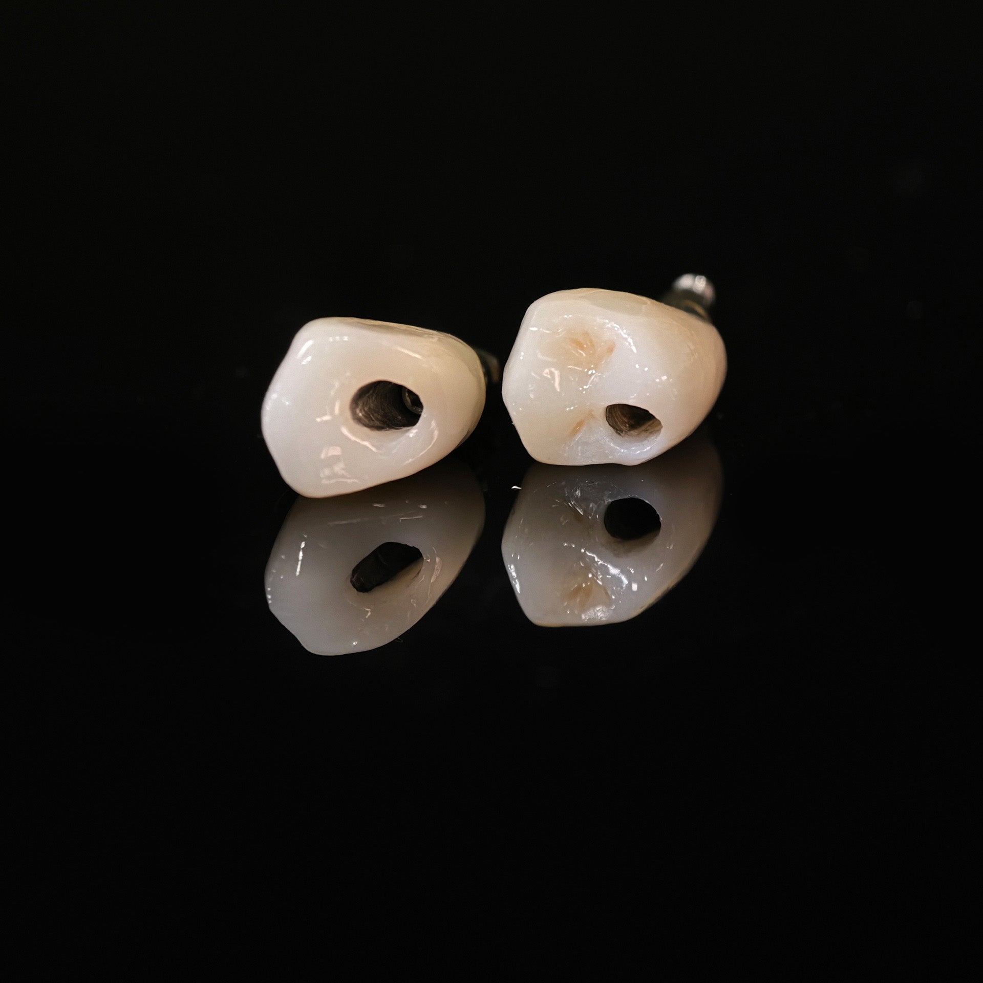 Zirconia Crowns With Screw Retained