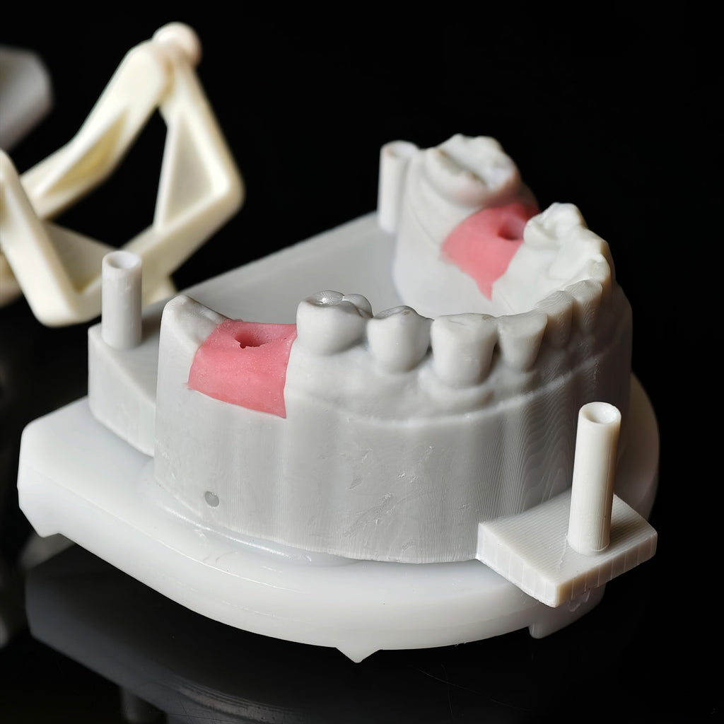 Zirconia Crowns With Screw Retained