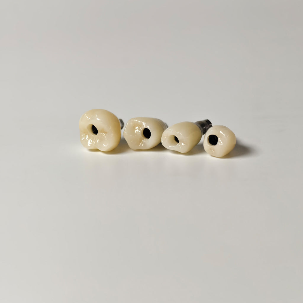 Zirconia Crowns With Screw Retained