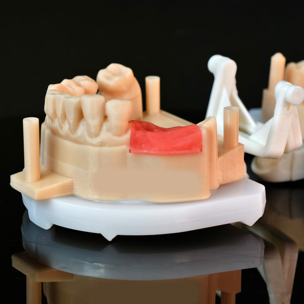 Zirconia Crowns With Screw Retained
