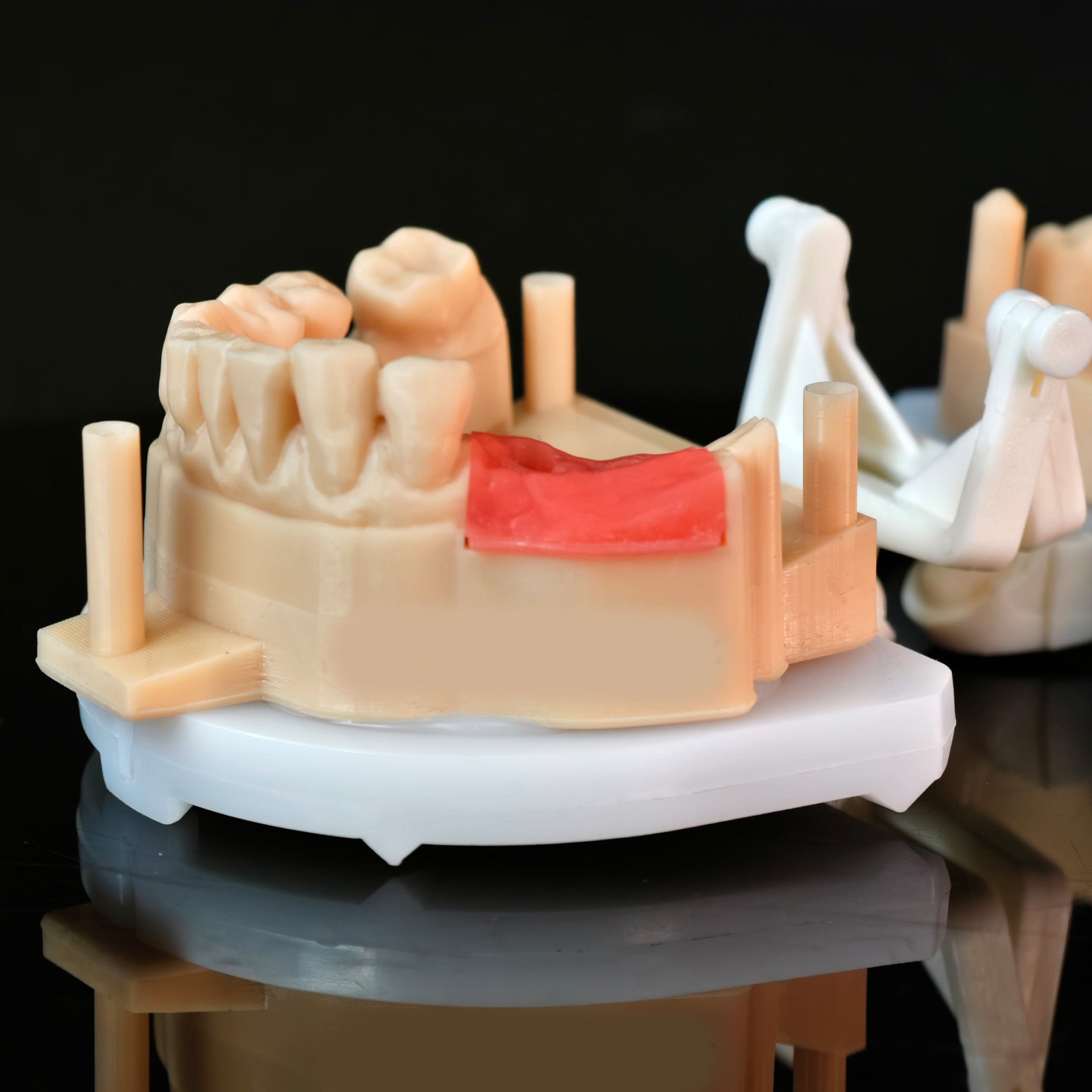 Zirconia Crowns With Screw Retained