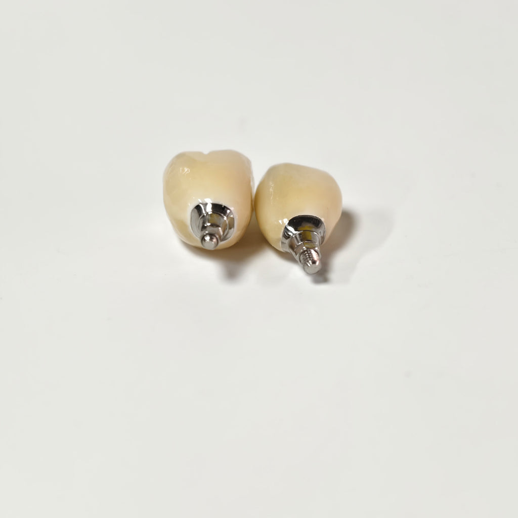 Zirconia Crowns With Screw Retained