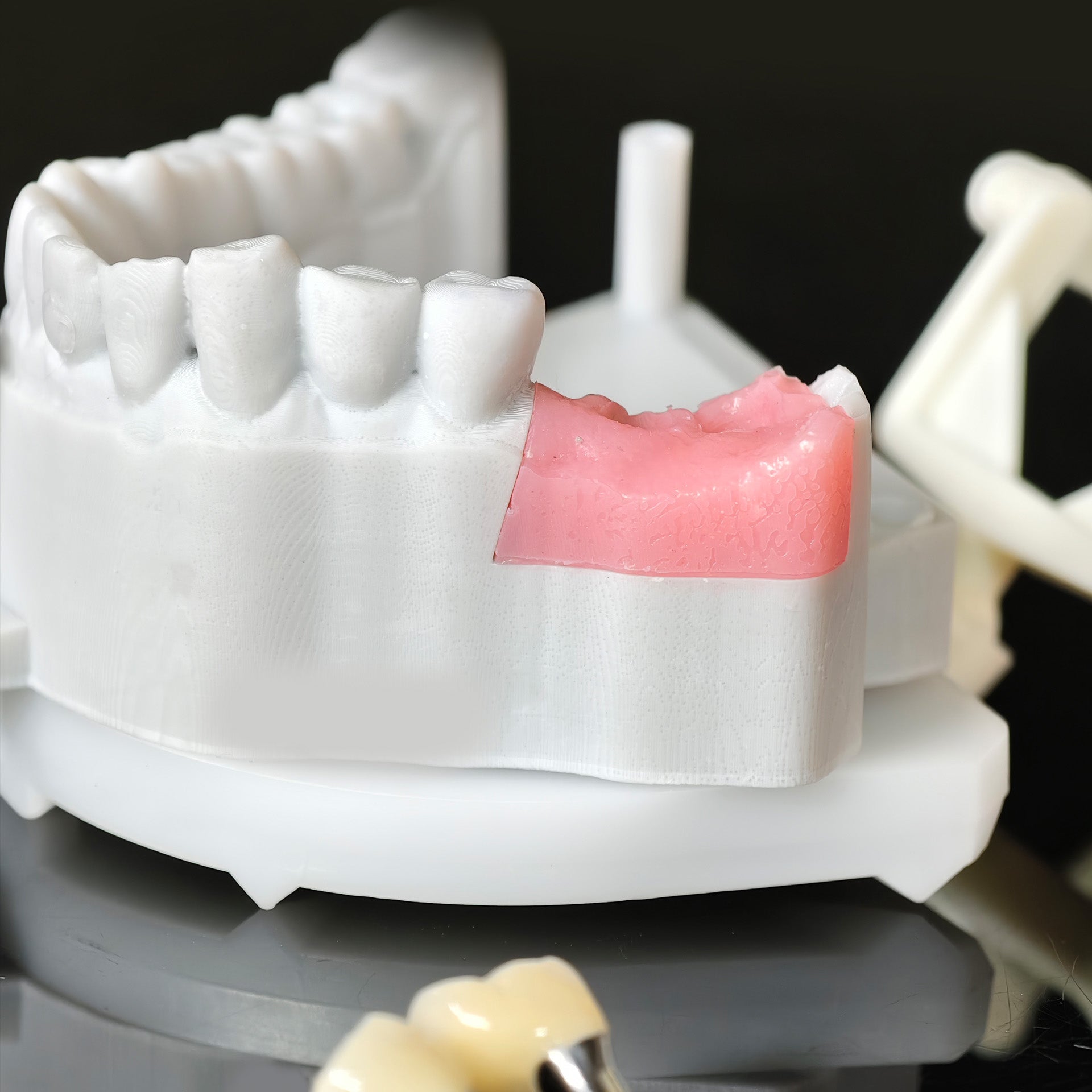 Zirconia Crowns With Screw Retained