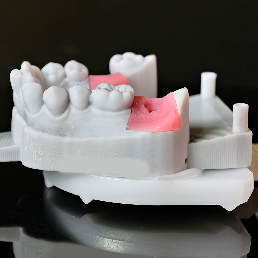 Zirconia Crowns With Screw Retained