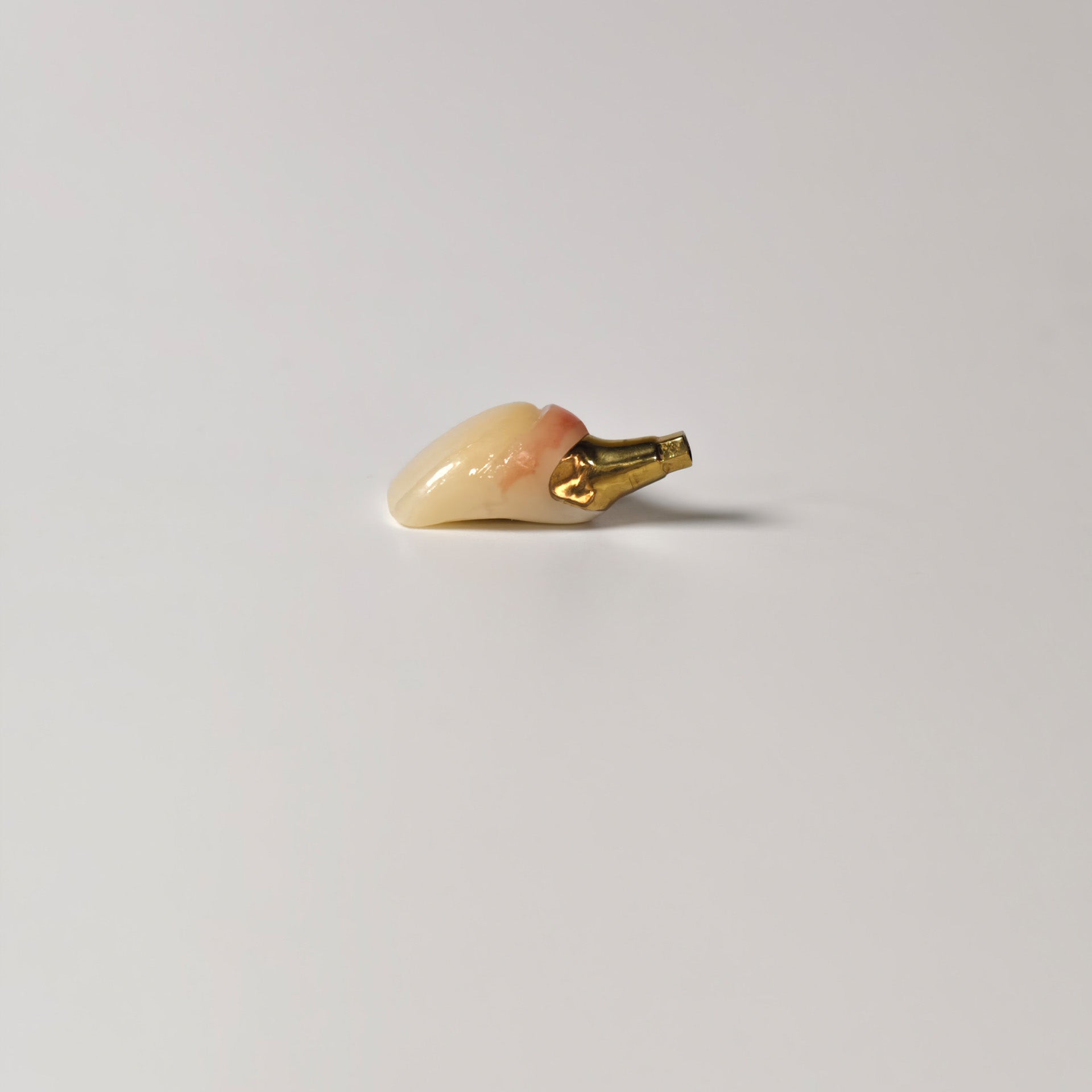 Zirconia Crown With Gold-Plated Abutment