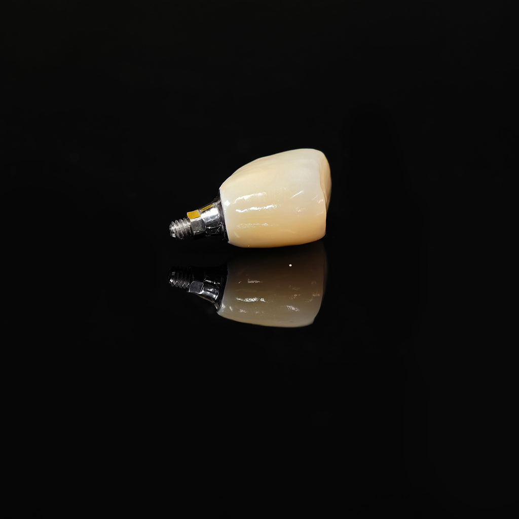 Zirconia Crown With Screw Retained