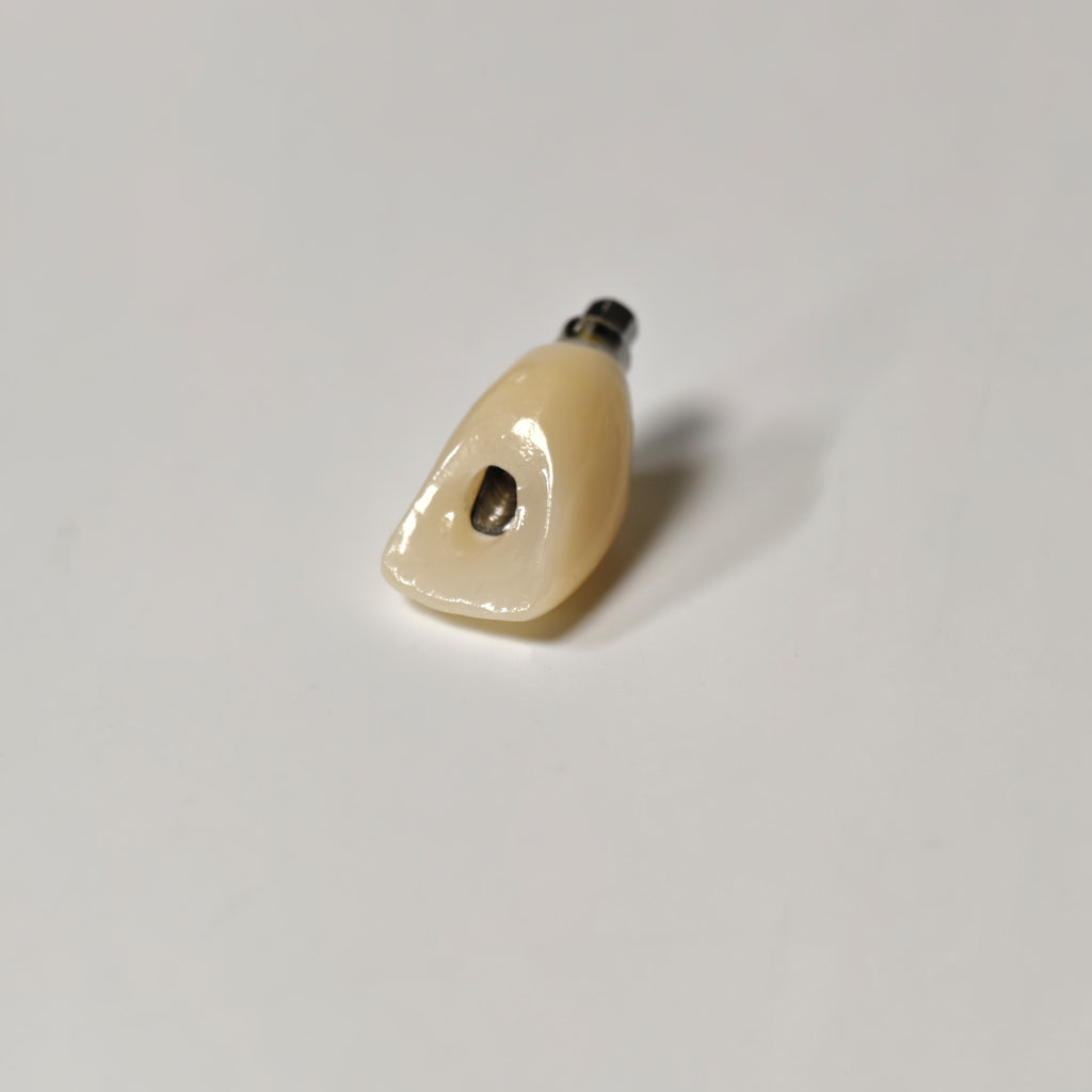 Zirconia Crown With Screw Retained